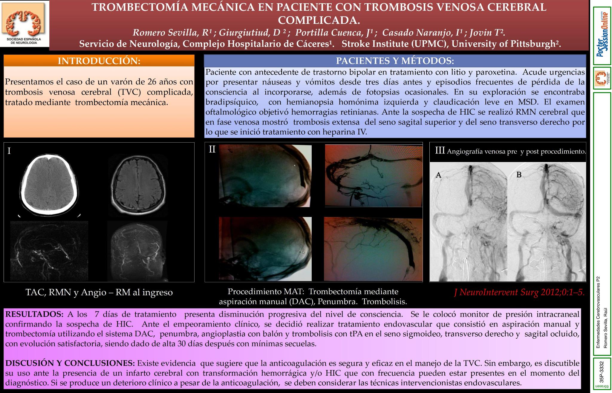 Trombectomía mecánica en paciente con trombosis venosa cerebral complicada