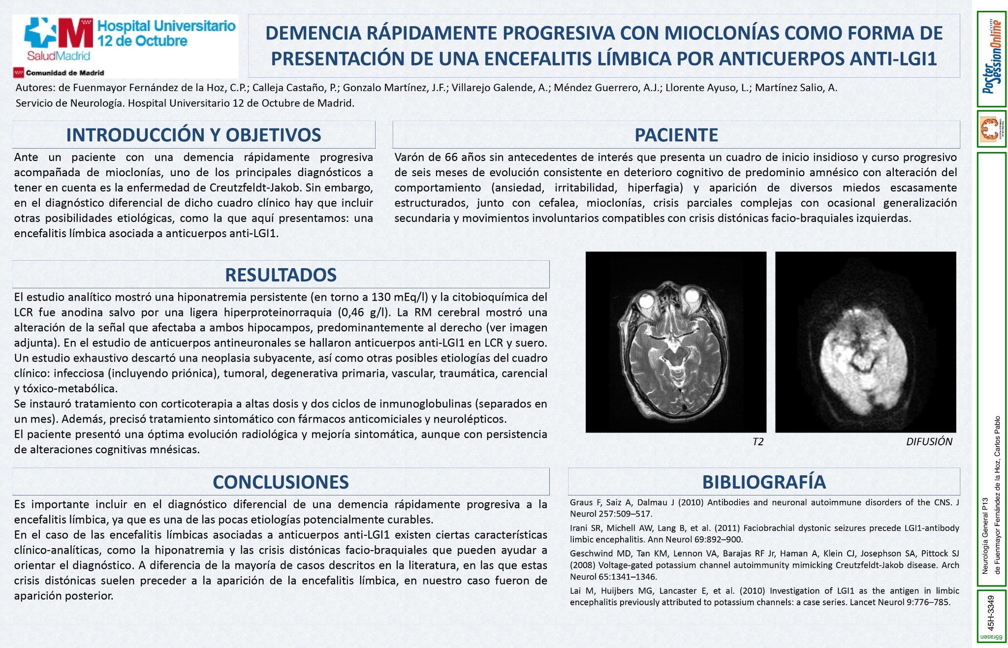 Demencia rápidamente progresiva con mioclonías como forma de presentación de una encefalitis límbica por anticuerpos anti-LGI1.