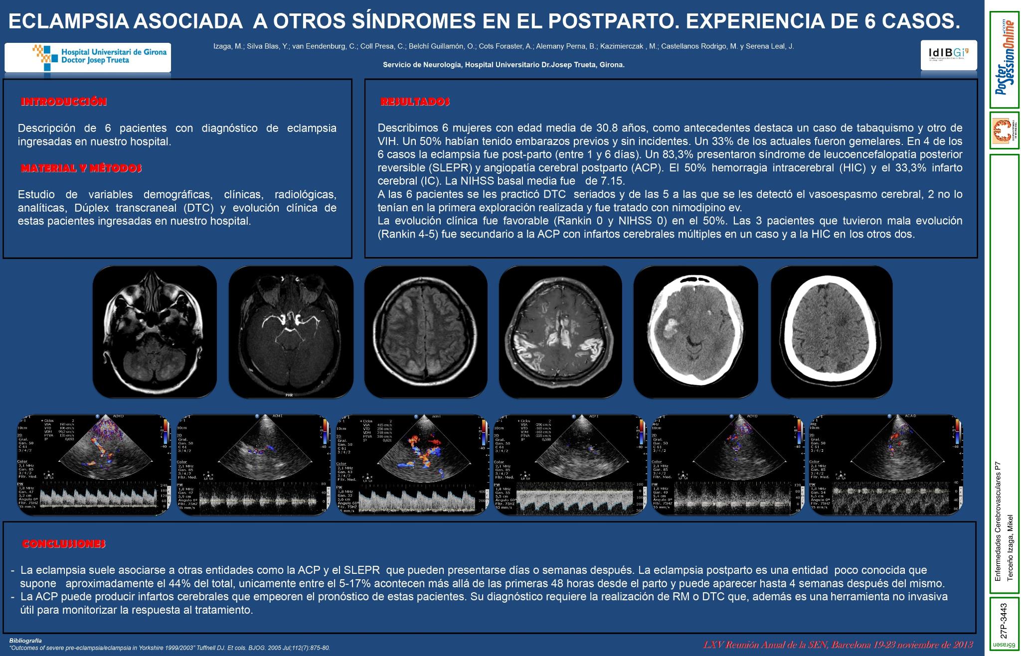 Eclampsia asociada a otros síndromes en el postparto. Experiencia de 6 casos
