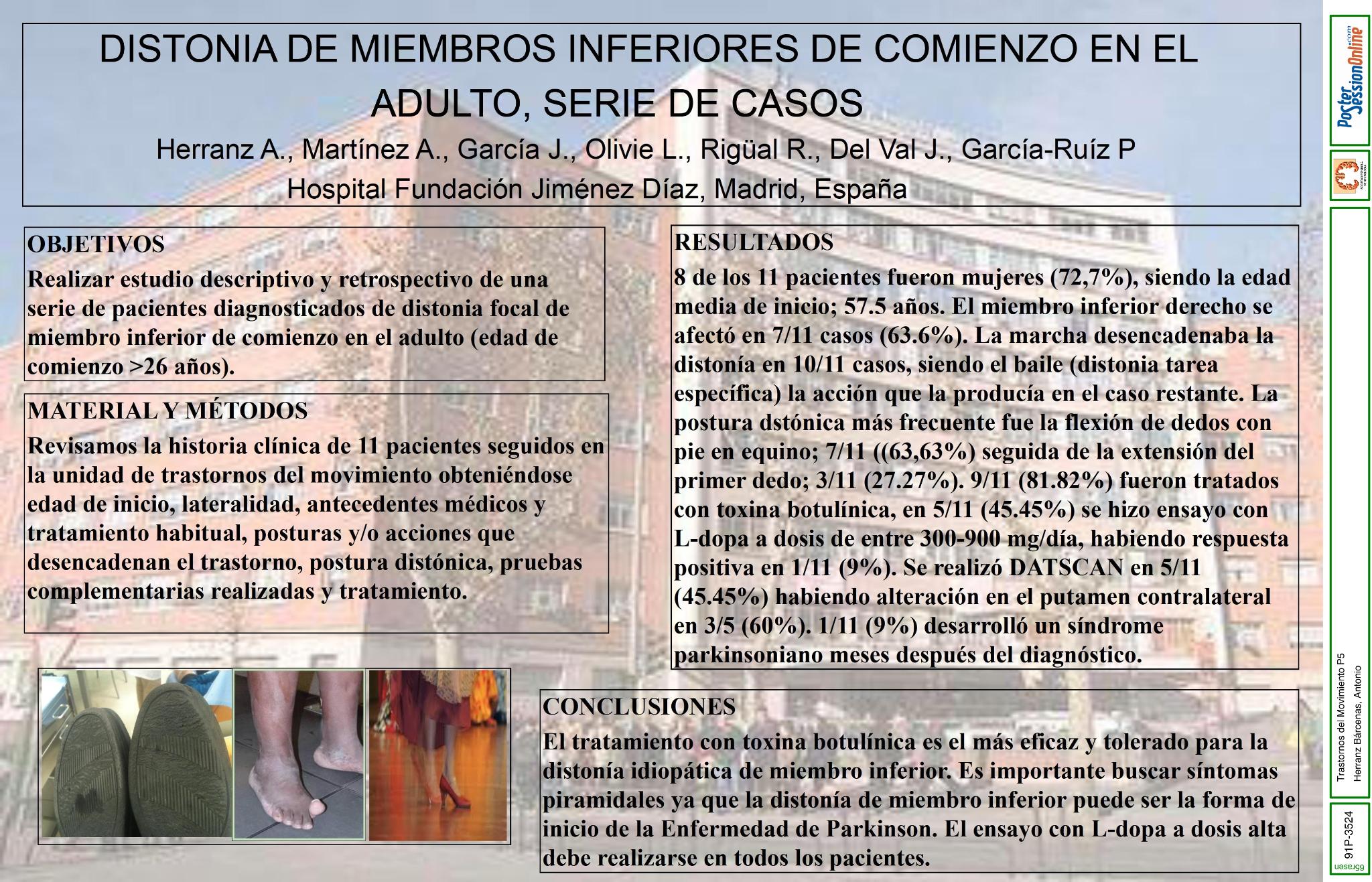 Distonia de miembro inferior de comienzo en el adulto, una serie de casos