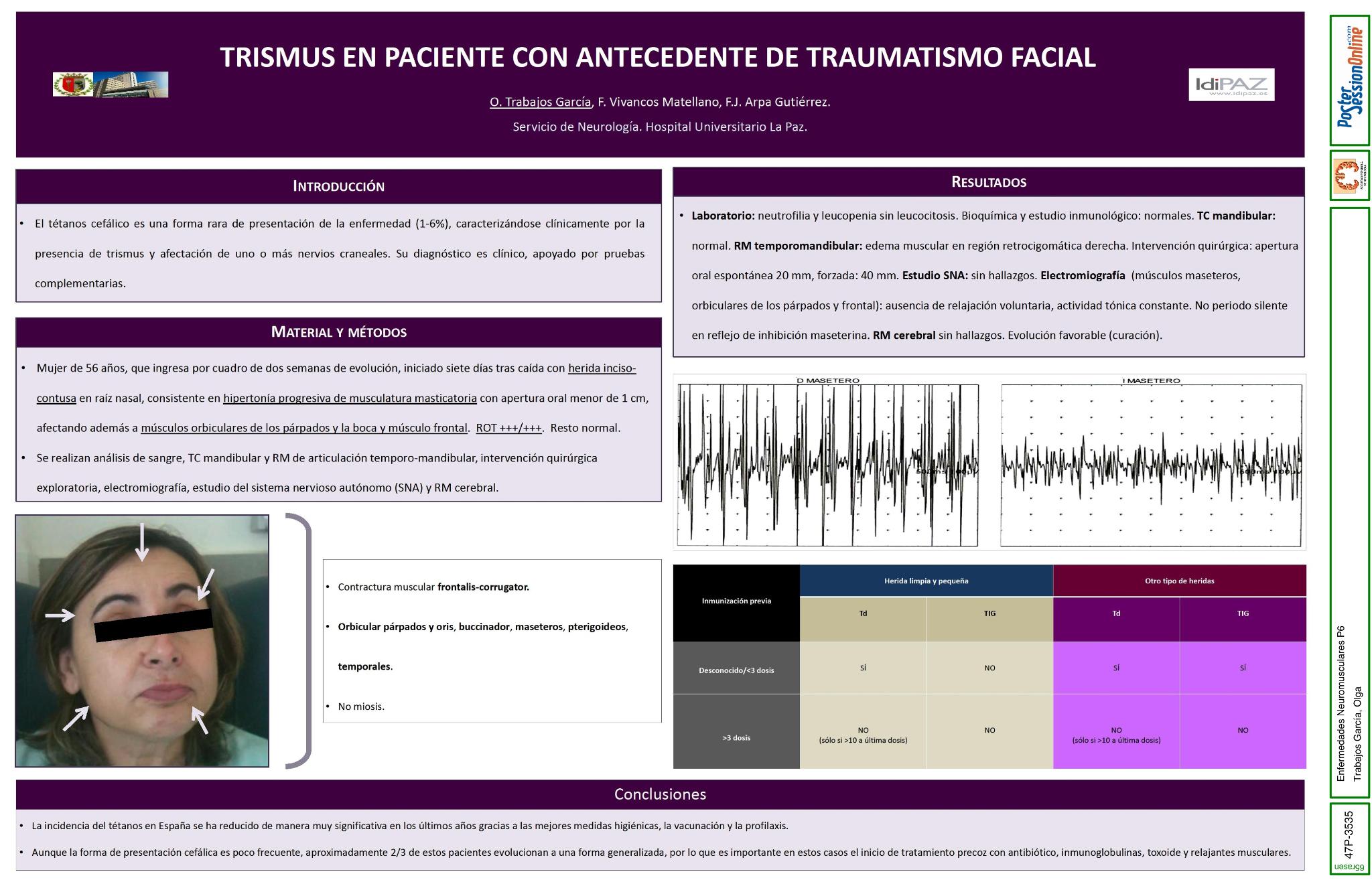 Trismus en paciente con antecedente de traumatismo facial