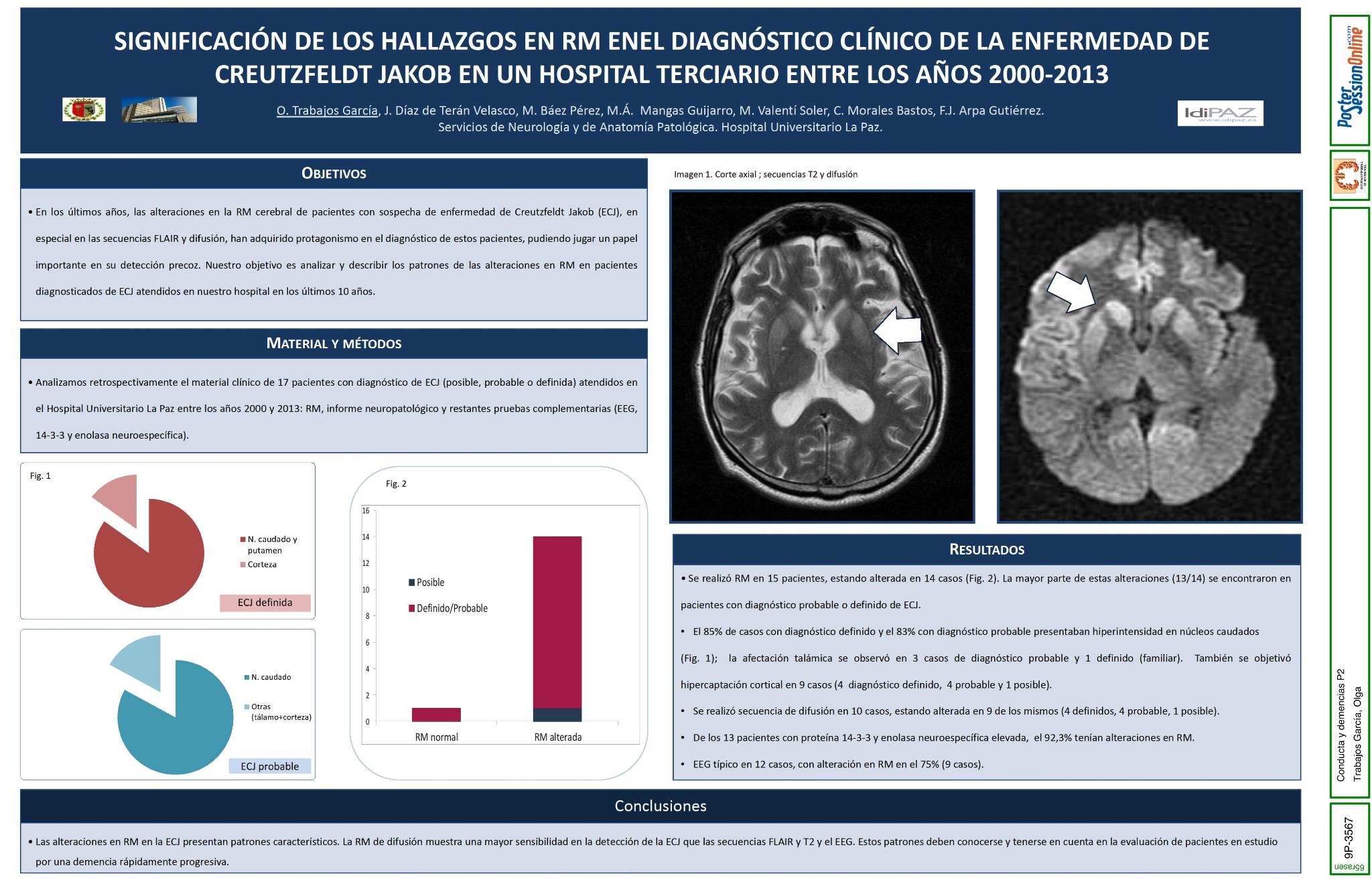 Significación de los hallazgos en RM en el diagnóstico clínico de la enfermedad de Creutzfeldt Jakob en un hospital terciario entre los años 2000-2013