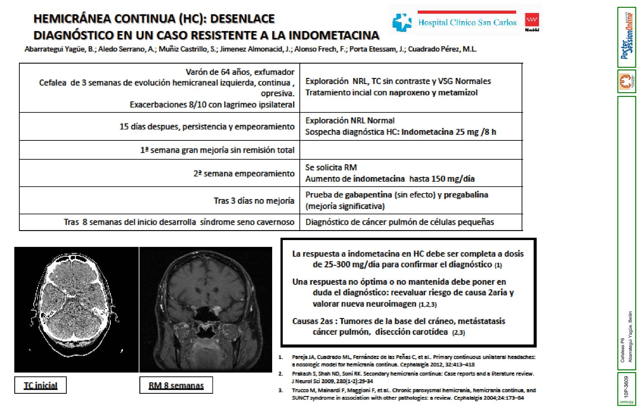 Hemicránea continua: desenlace diagnóstico en un caso resistente a la indometacina
