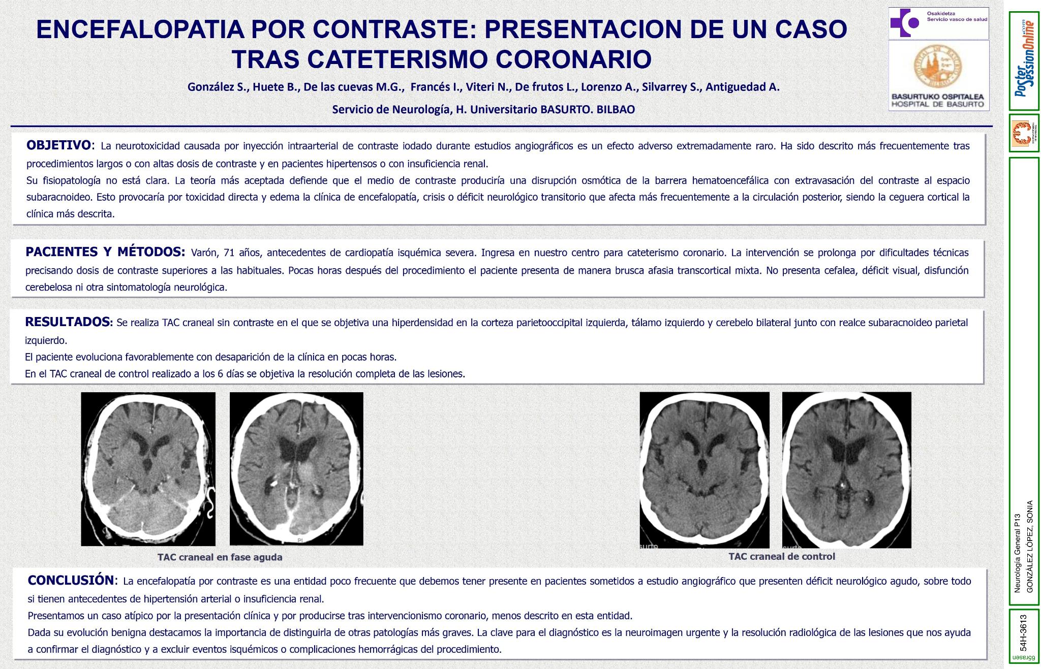 Encefalopatía por contraste: presentación de un caso tras cateterismo coronario