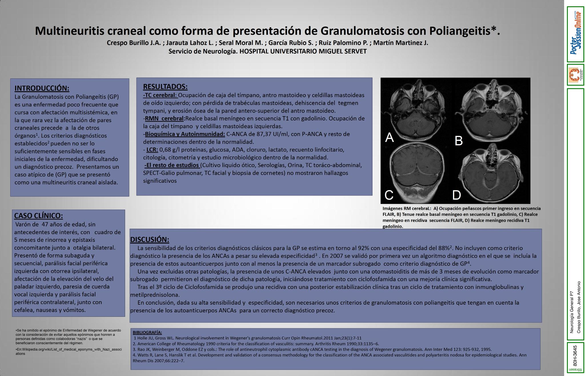 Multineuritis craneal como forma de presentación de Granulomatosis con Poliangeitis (Enfermedad de Wegener).