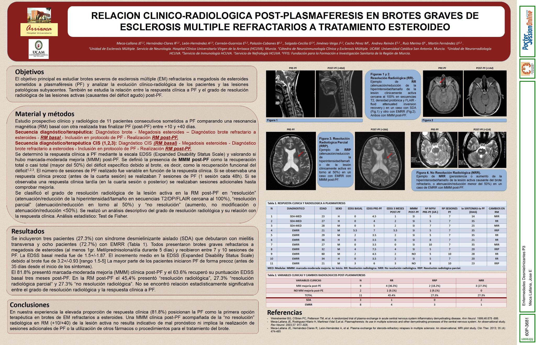 Relacion clinico-radiologica post-plasmaféresis en brotes graves de Esclerosis Multiple refractarios a tratamiento esteroideo