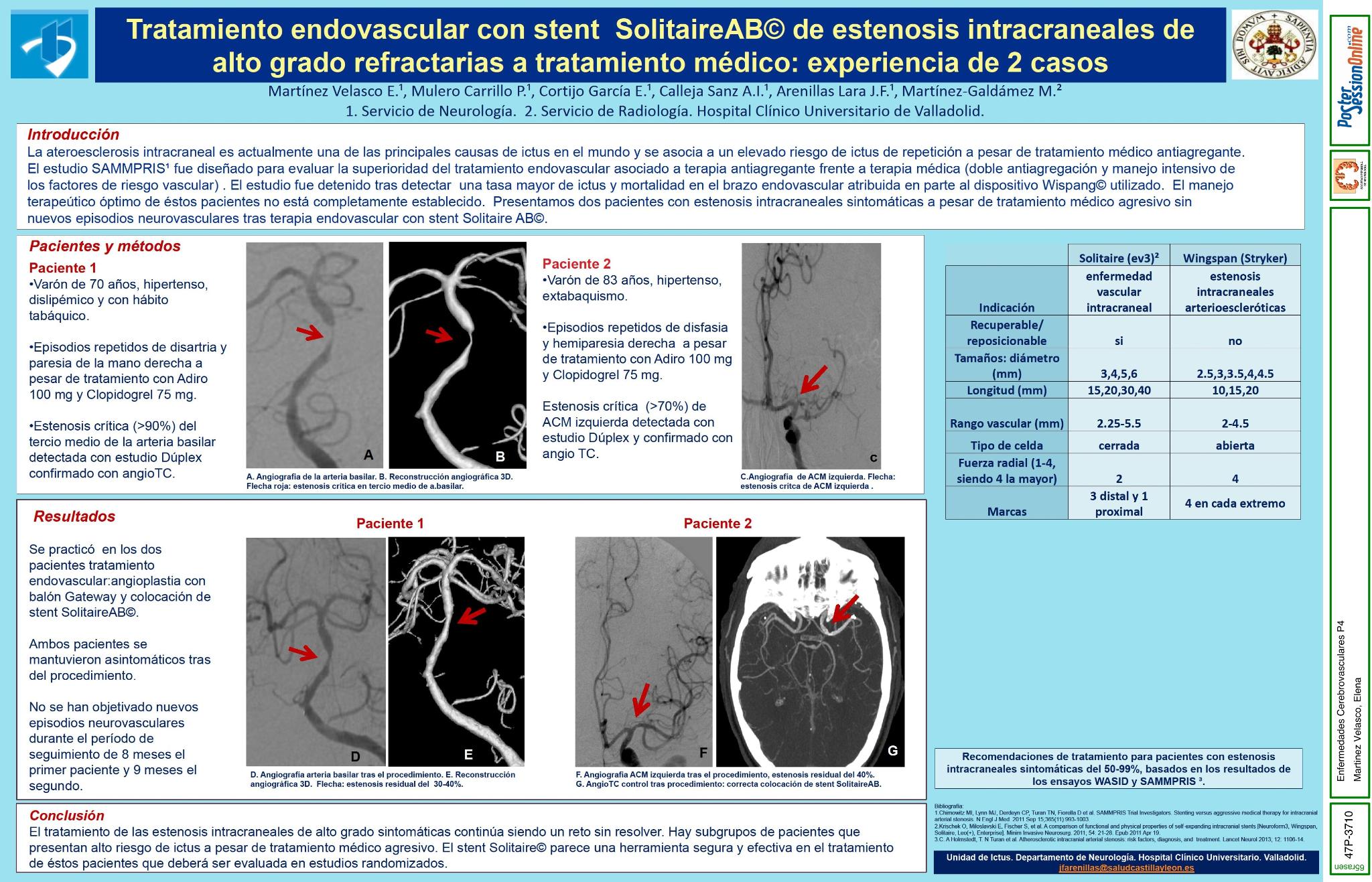 Tratamiento endovascular con stent Solitaire© de estenosis intracraneales de alto grado refractarias a tratamiento médico: experiencia de 2 casos