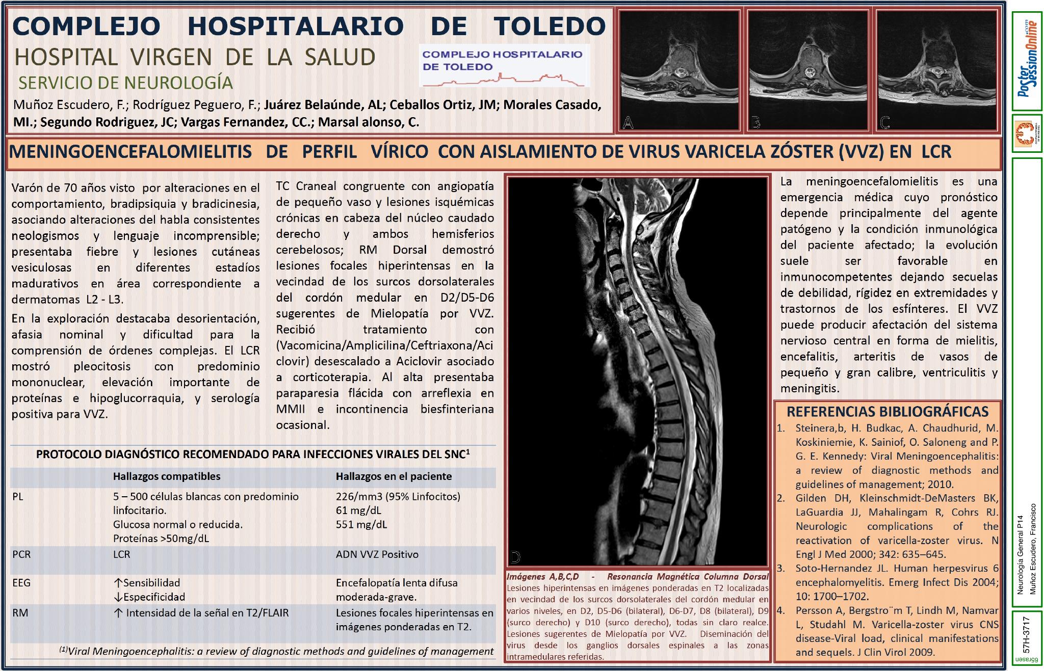 Meningoencefalomielitis de perfil vírico con aislamiento de Virus Varicela Zóster (VVZ) en LCR