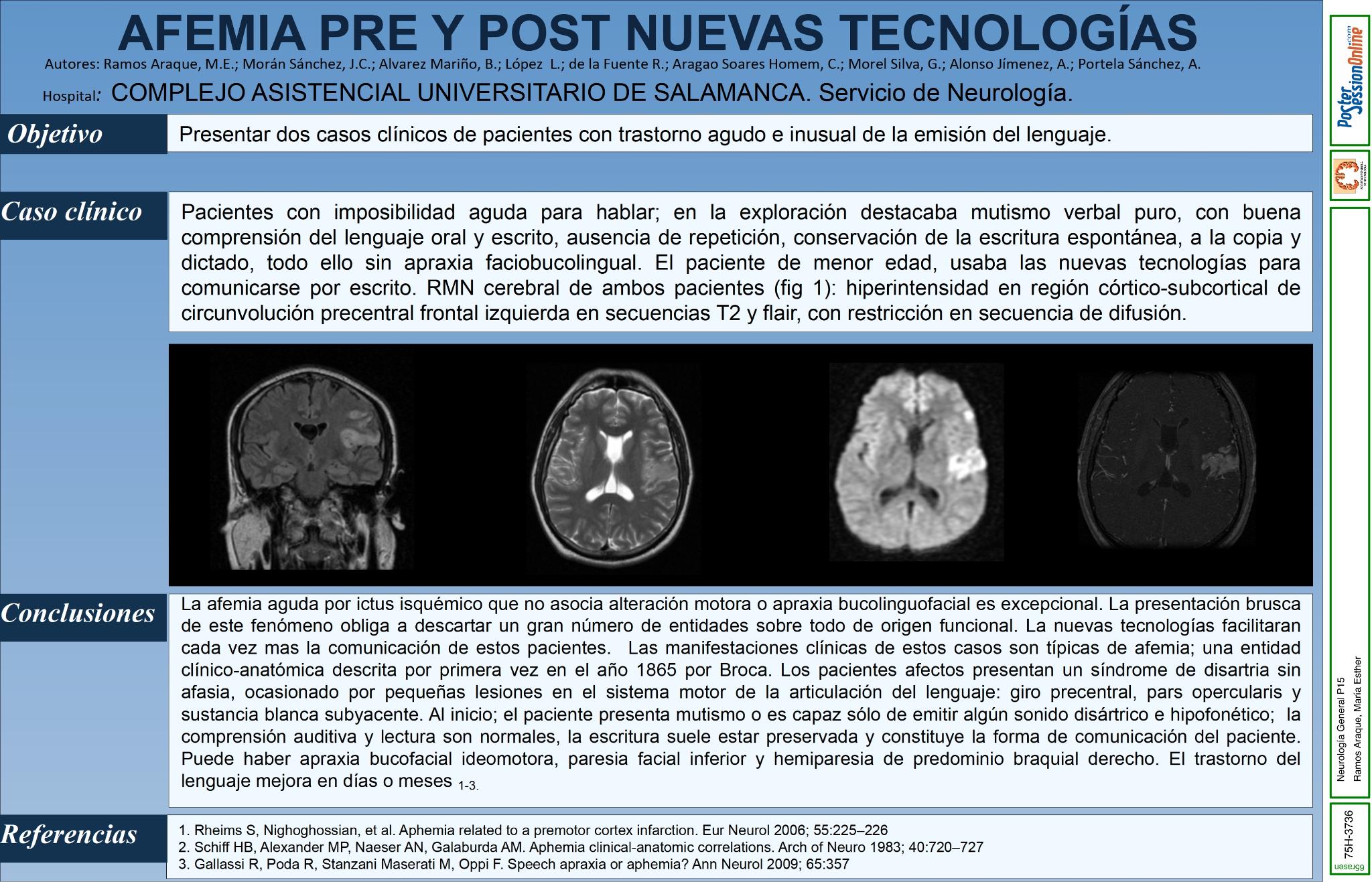 Afemia pre y post nuevas tecnologías.