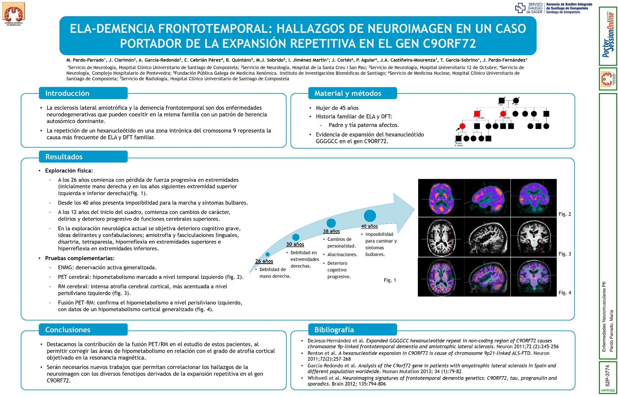 ELA-Demencia frontotemporal: hallazgos de neuroimagen en un caso portador de la expansión repetitiva en el gen C9ORF72