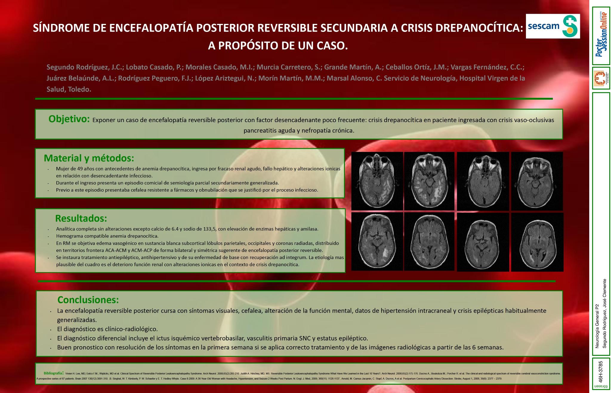 Síndrome de encefalopatía posterior reversible secundaria a crisis drepanocítica. A propósito de un caso