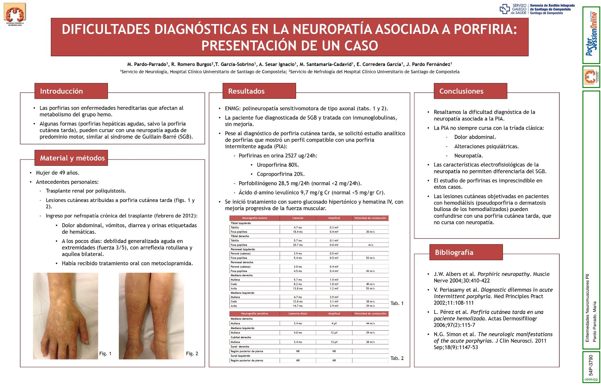Dificultades diagnósticas en la neuropatía asociada a porfiria. Presentación de un caso