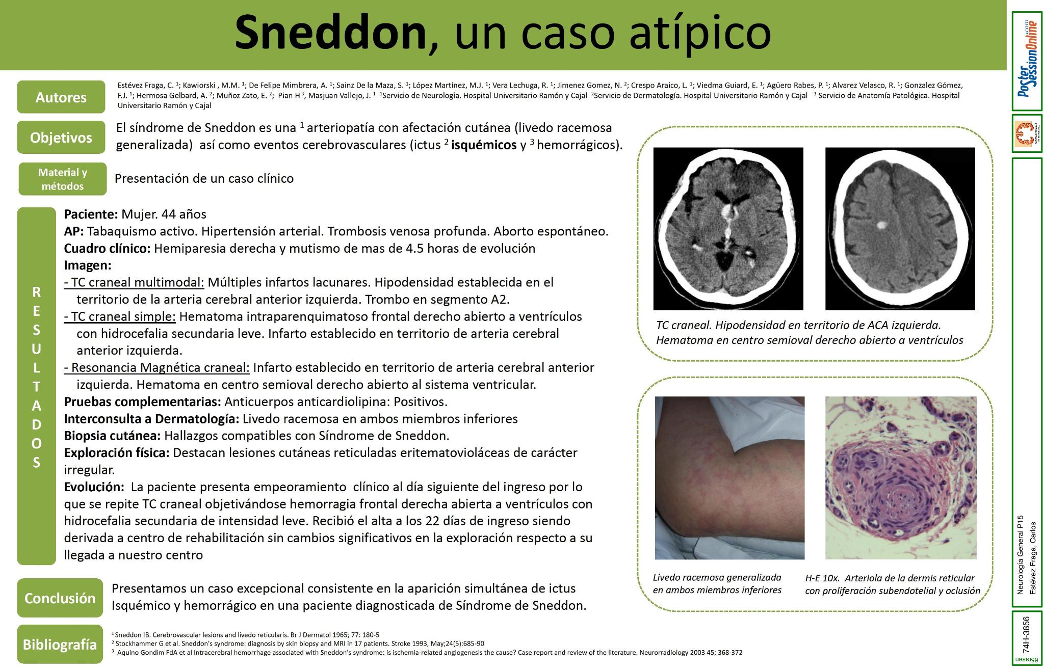 Sneddon, el príncipe de Constantinopla