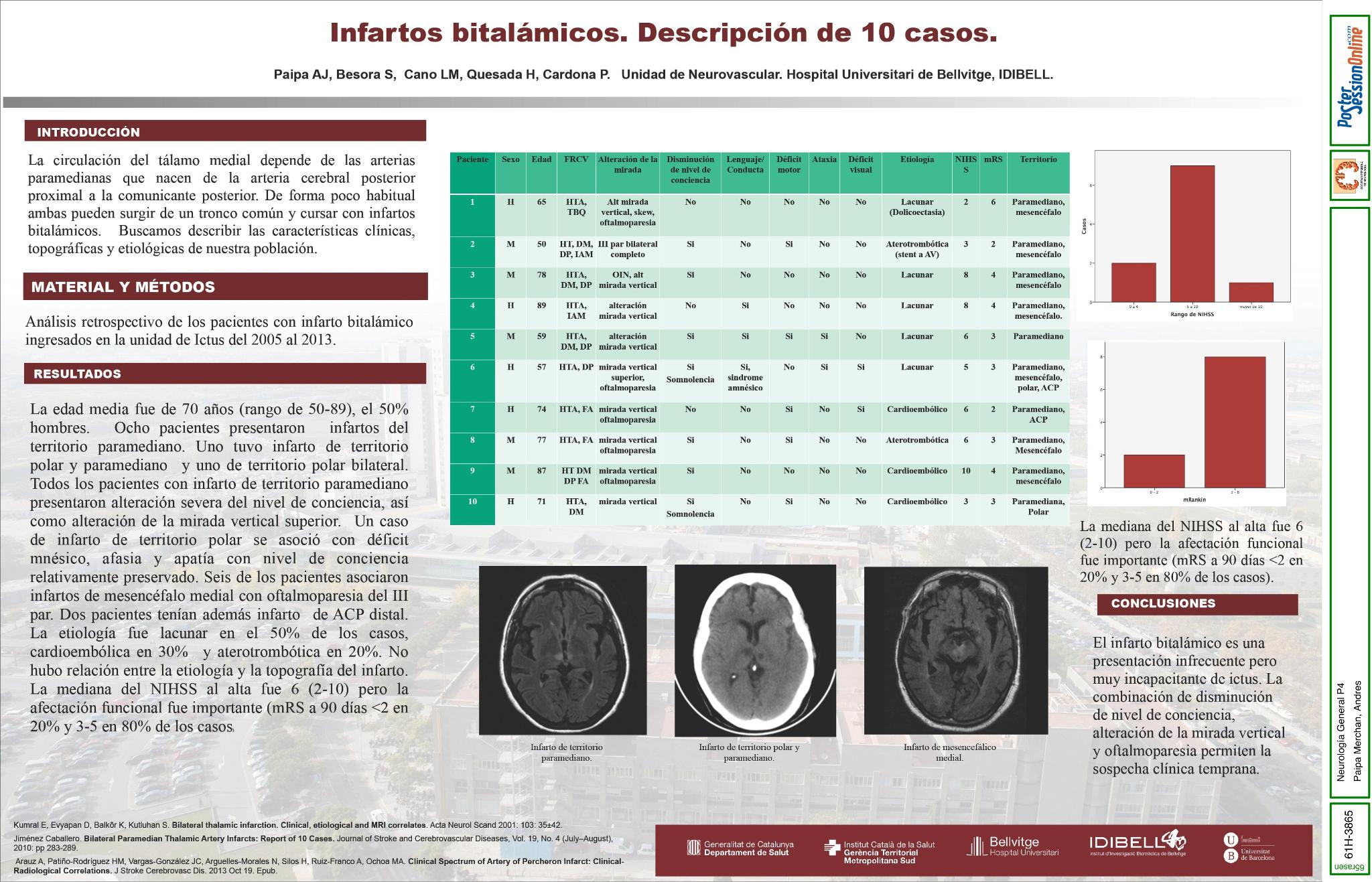Infartos bitalámicos. Descripción de 10 casos.