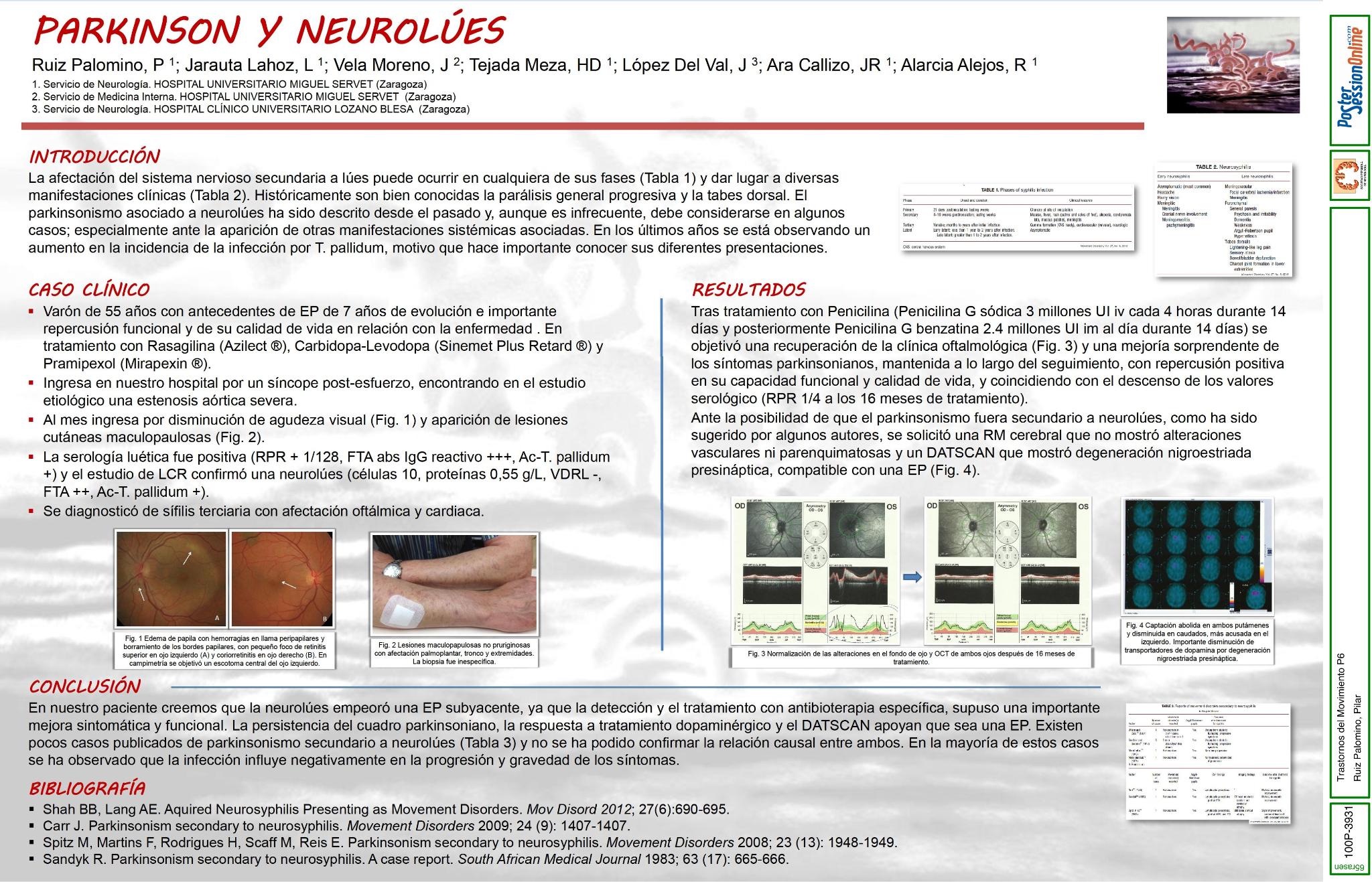 Parkinson y neurolúes
