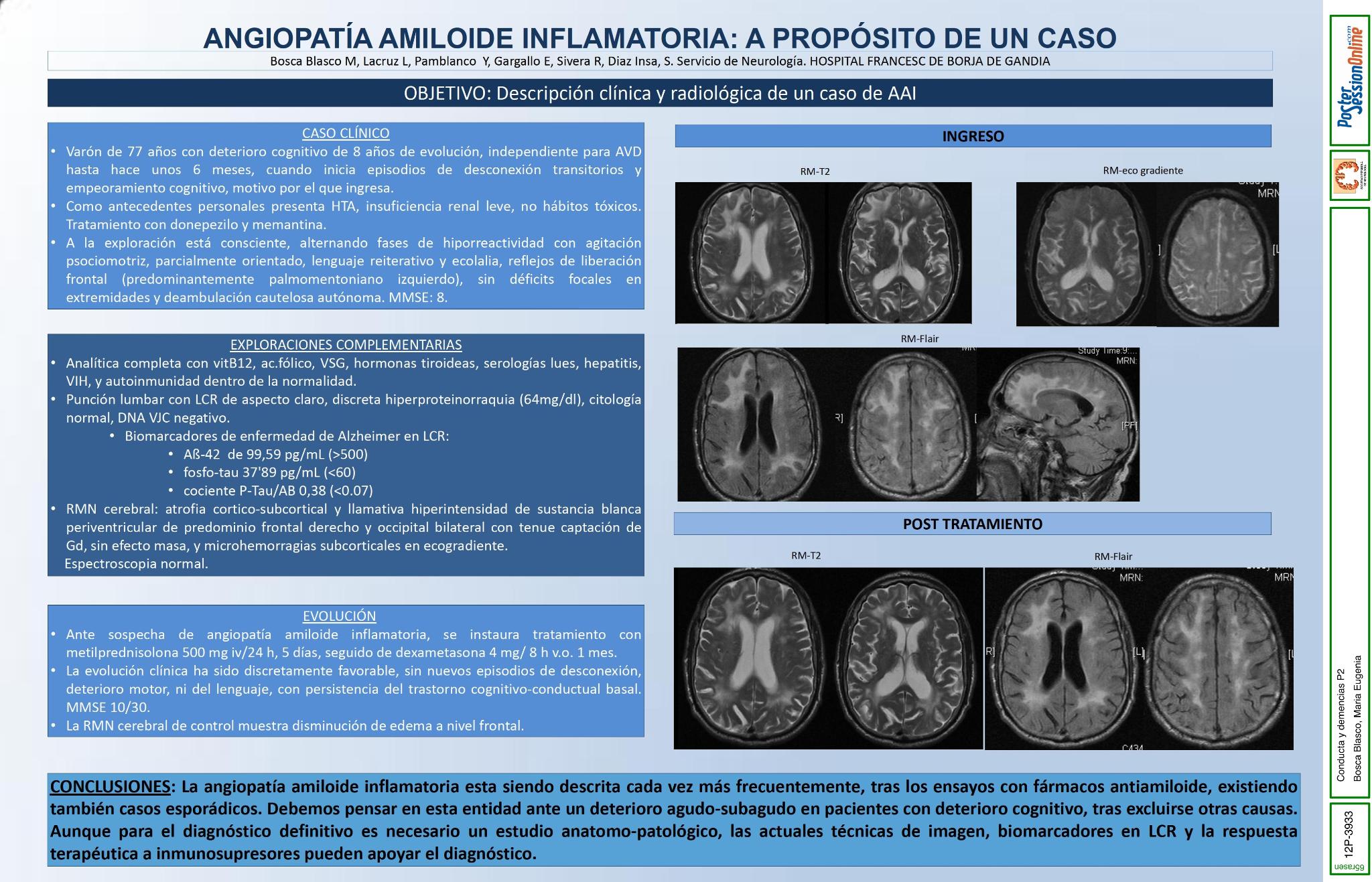 Angiopatía amiloide inflamatoria: a propósito de un caso
