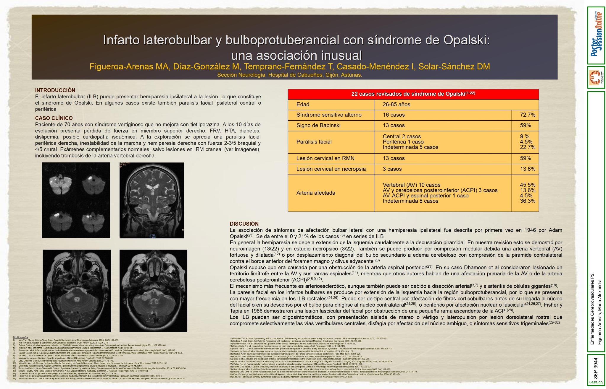 Infarto laterobulbar y bulboprotuberancial con síndrome de Opalski: una asociación inusual