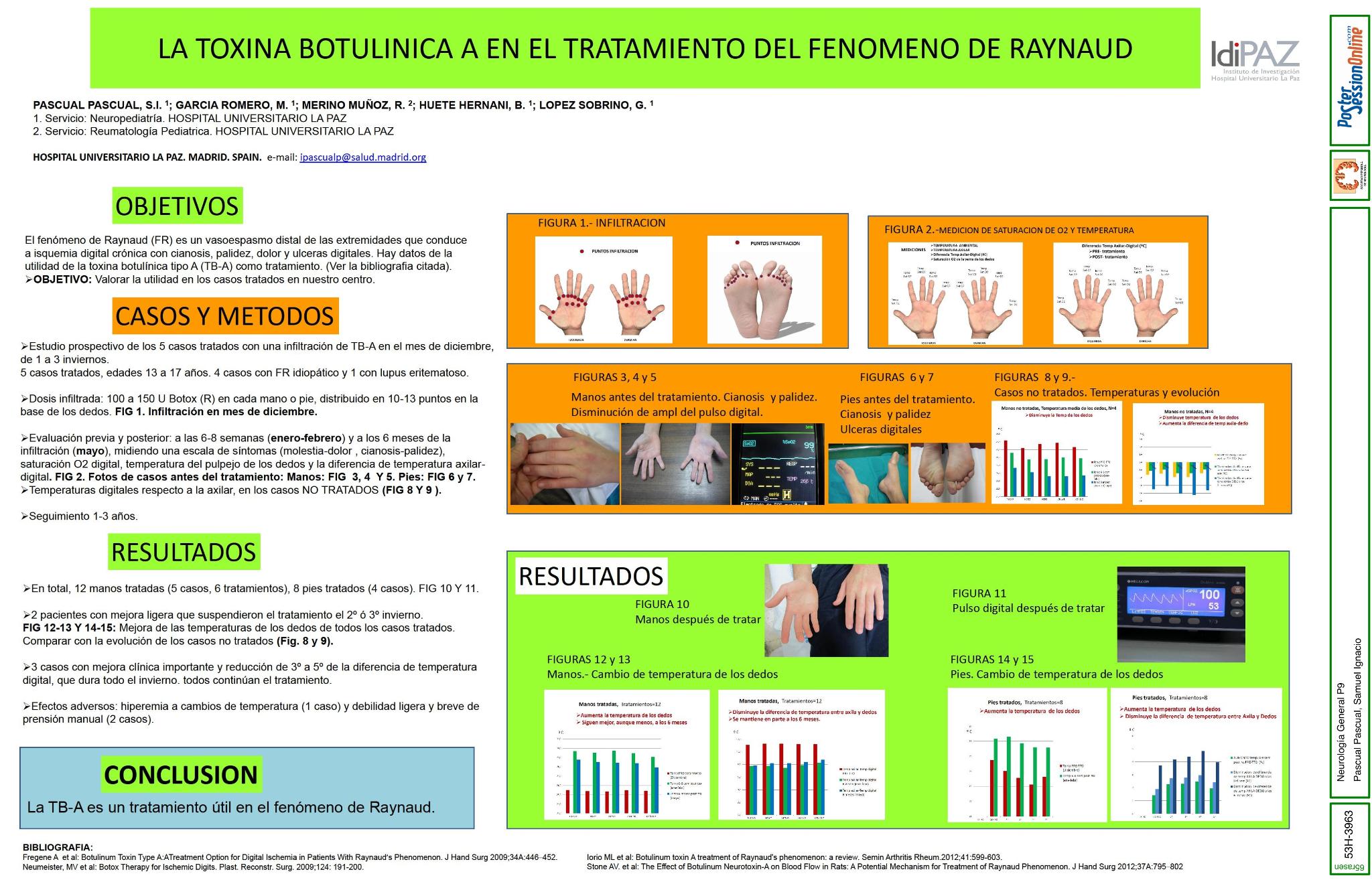 La toxina botulinica A en el tratamiento del fenomeno de Raynaud