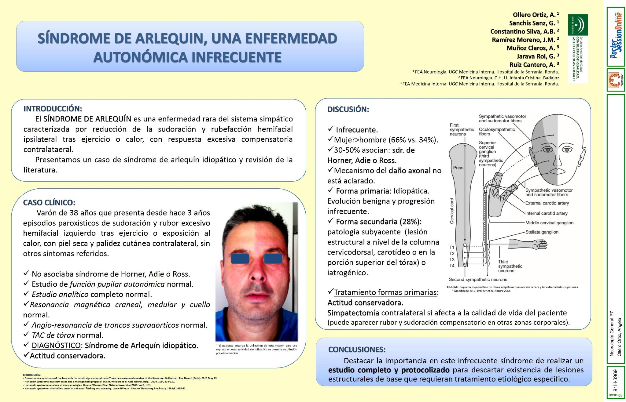 Síndrome de Arlequin, una enfermedad autonómica infrecuente
