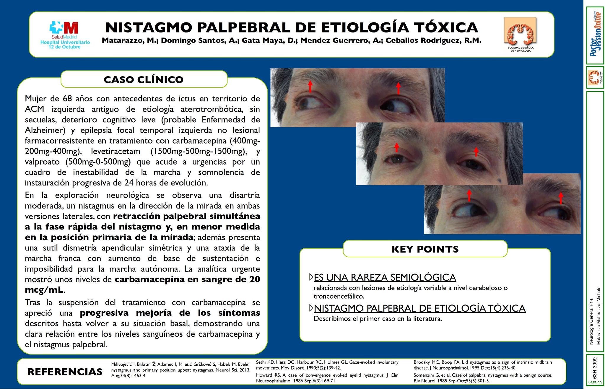 Nistagmo palpebral de etiología tóxica
