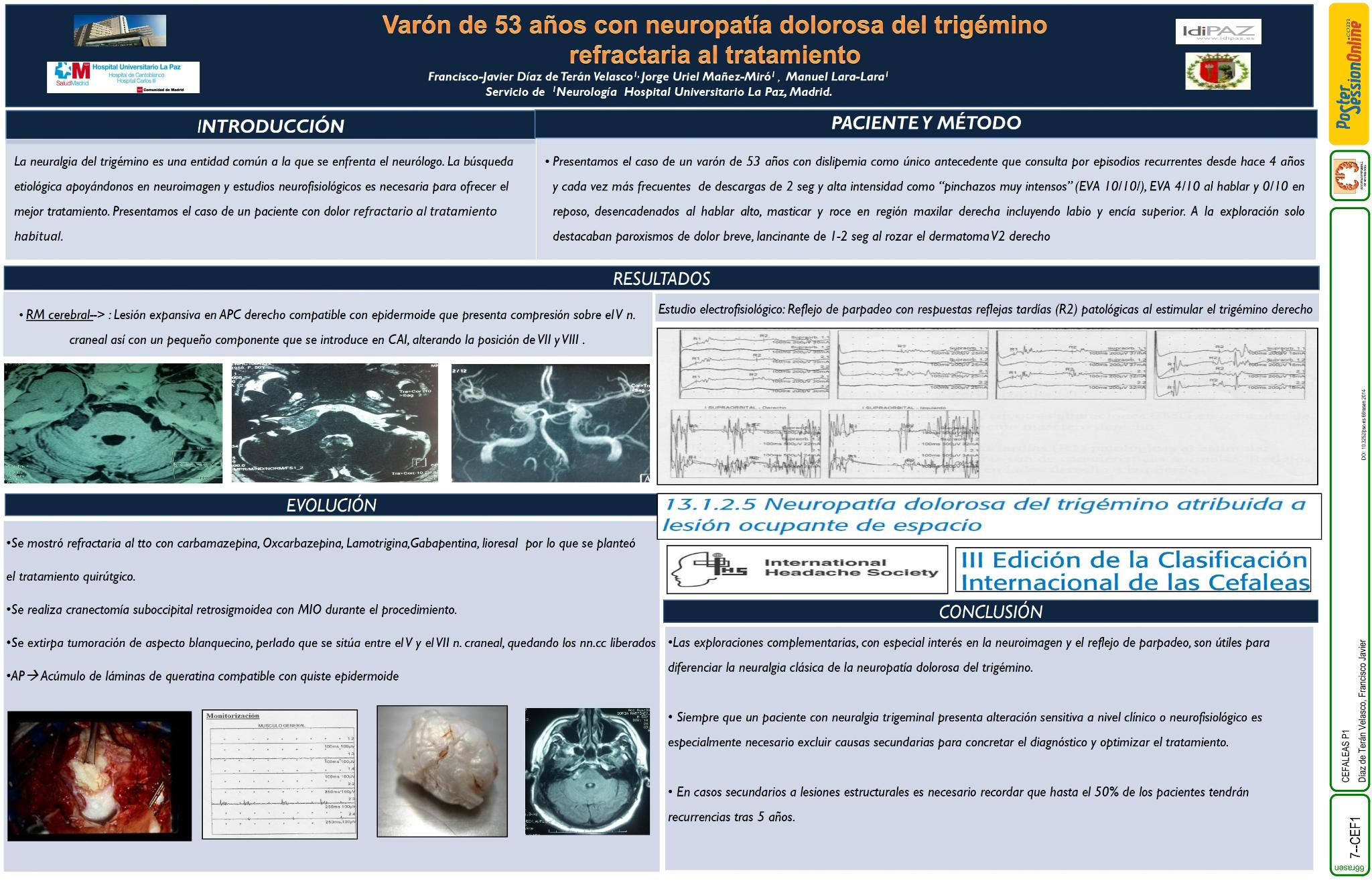 Varón de 53 años con neuropatía dolorosa del trigémino refractaria al tratamiento