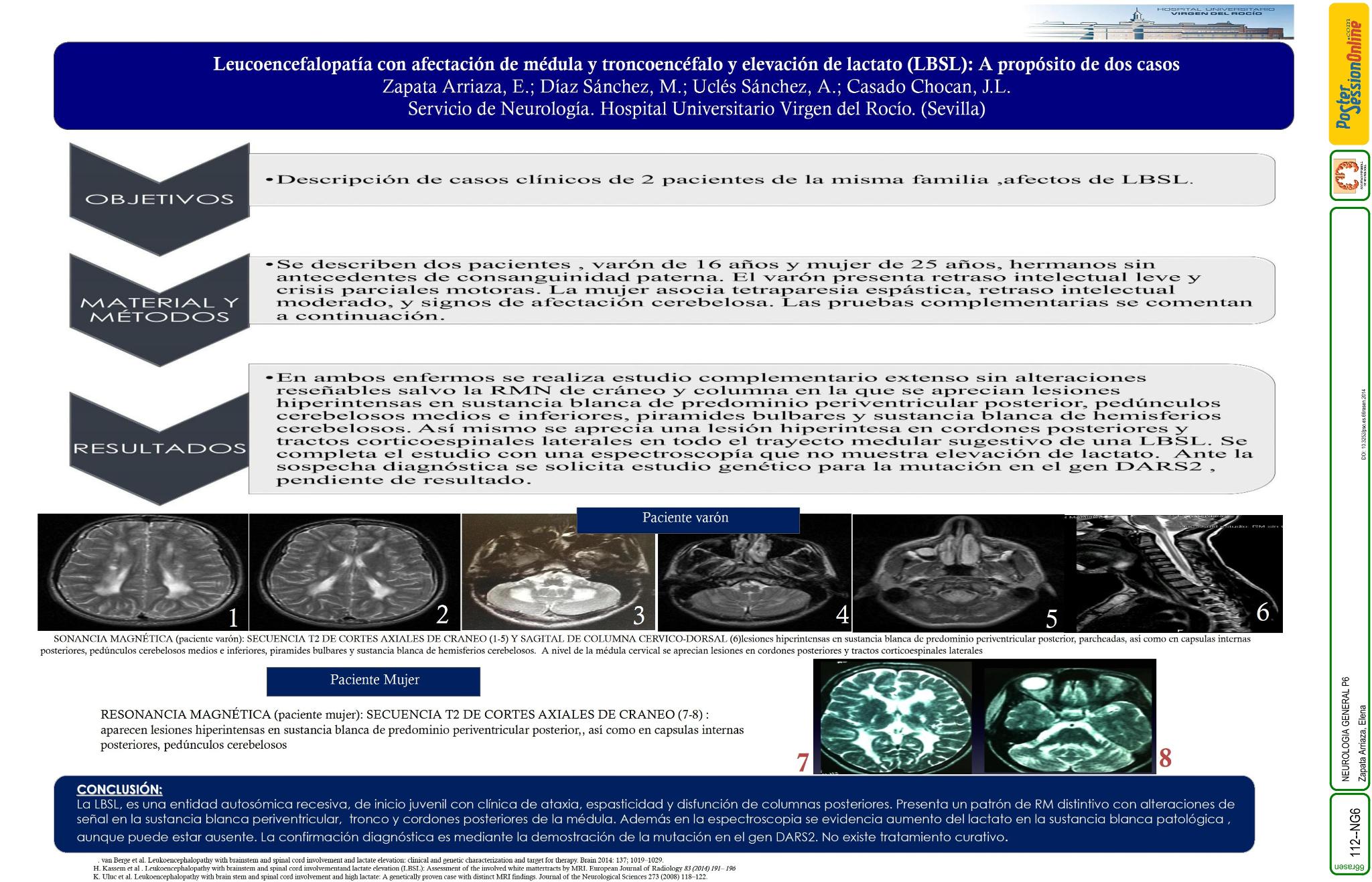 Leucoencefalopatía con afectación de médula y troncoencéfalo y elevación de lactato (LBSL): A propósito de dos casos