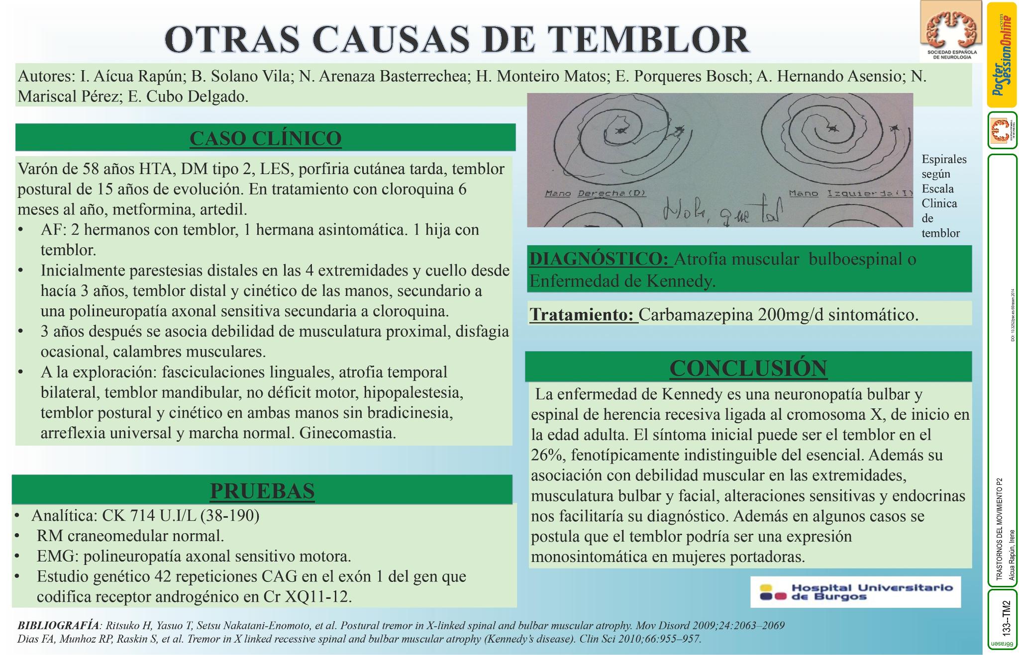 Otras causas de temblor