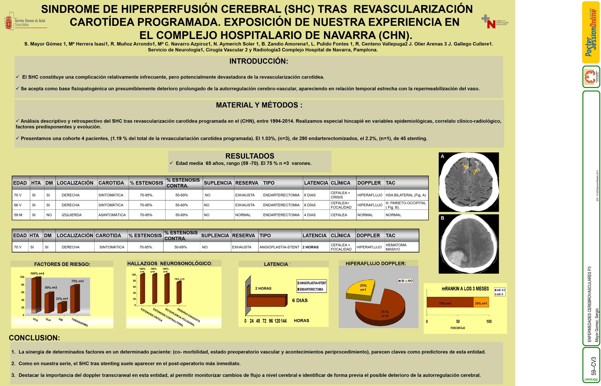 Sindrome de hiperperfusión cerebral (SHC) tras revascularización carotídea programada