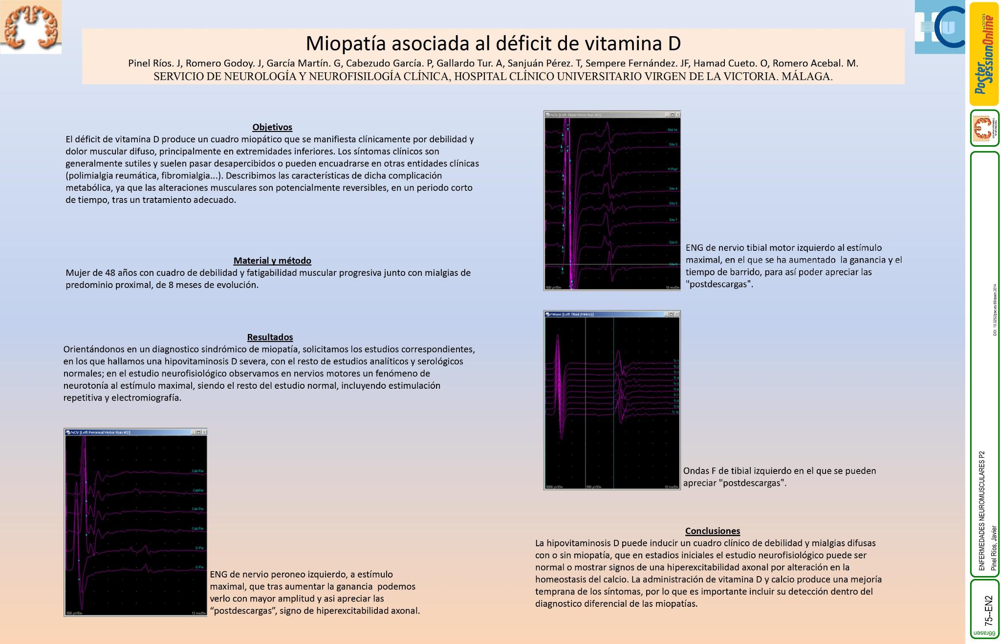 Miopatía asociada al déficit de vitamina D