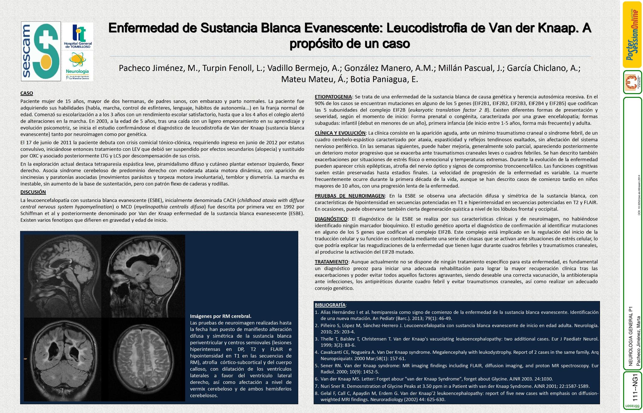Enfermedad de Sustancia Blanca Evanescente: Leucodistrofia de Van der Knaap con epilepsia sintomática. A propósito de un caso