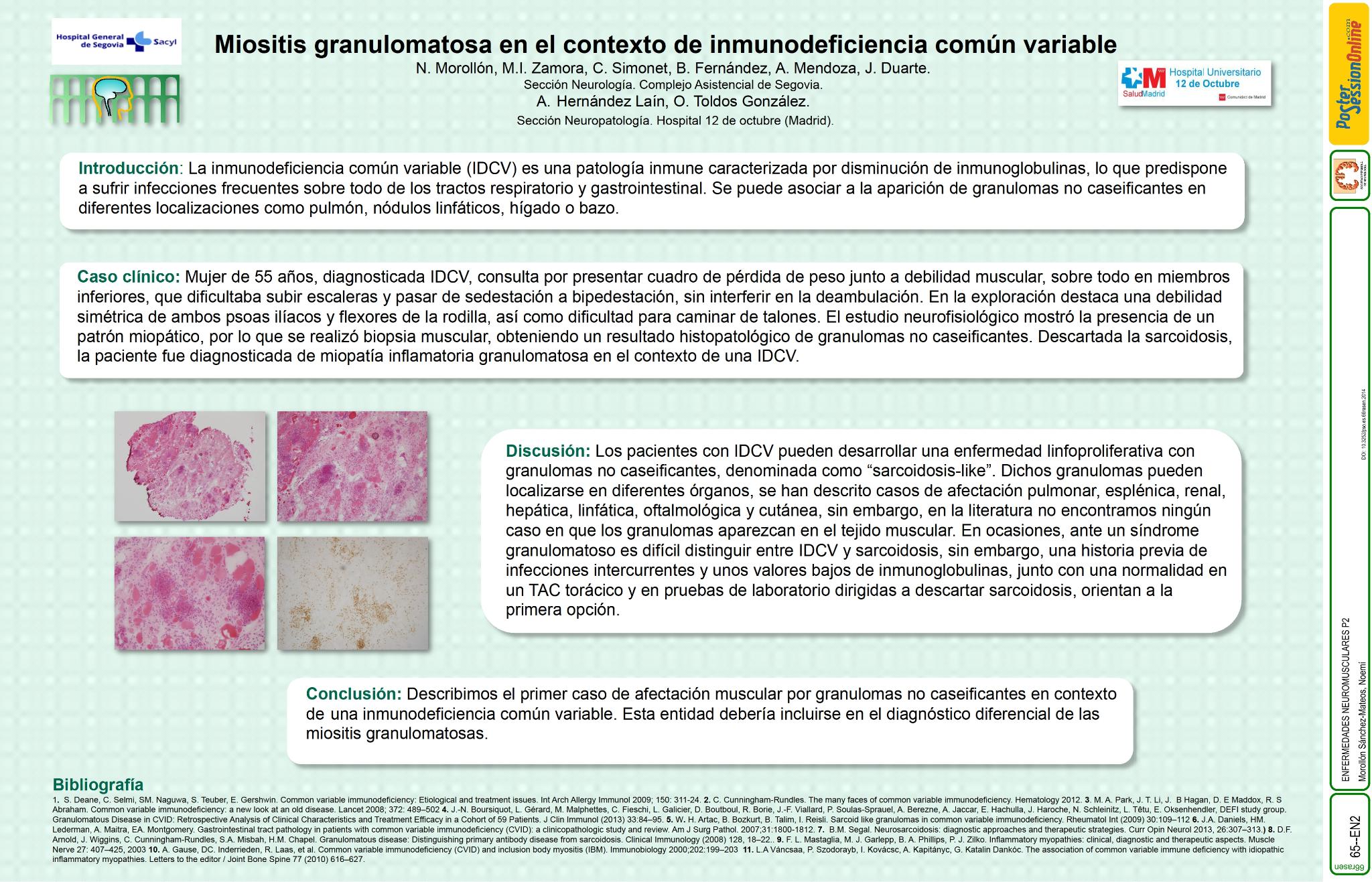 Miositis granulomatosa en el contexto de inmunodeficiencia común variable