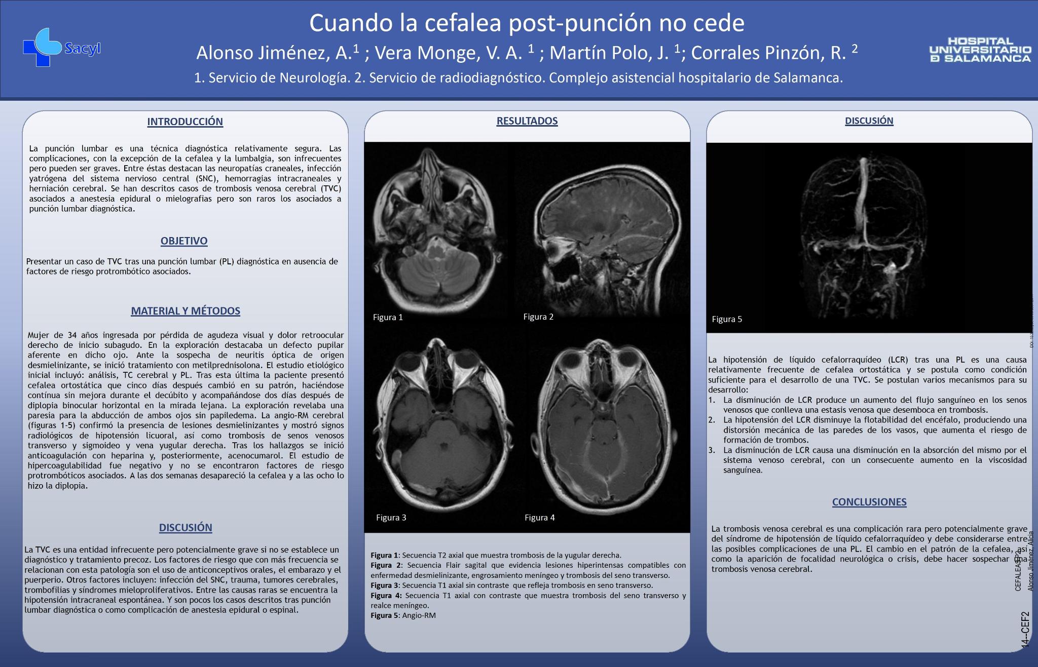 Cuando la cefalea post-punción no cede