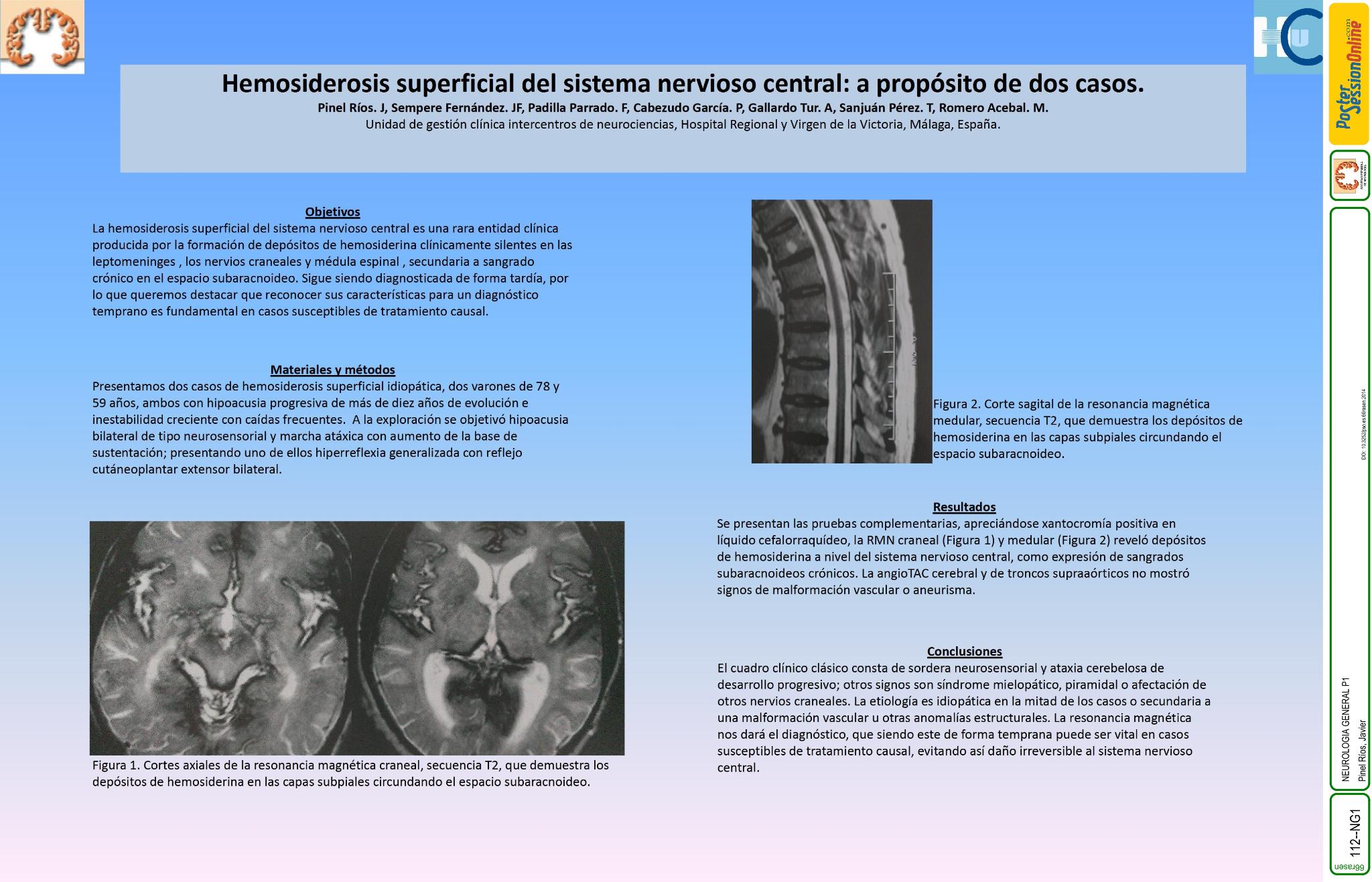 Hemosiderosis superficial del sistema nervioso central: a propósito de dos casos