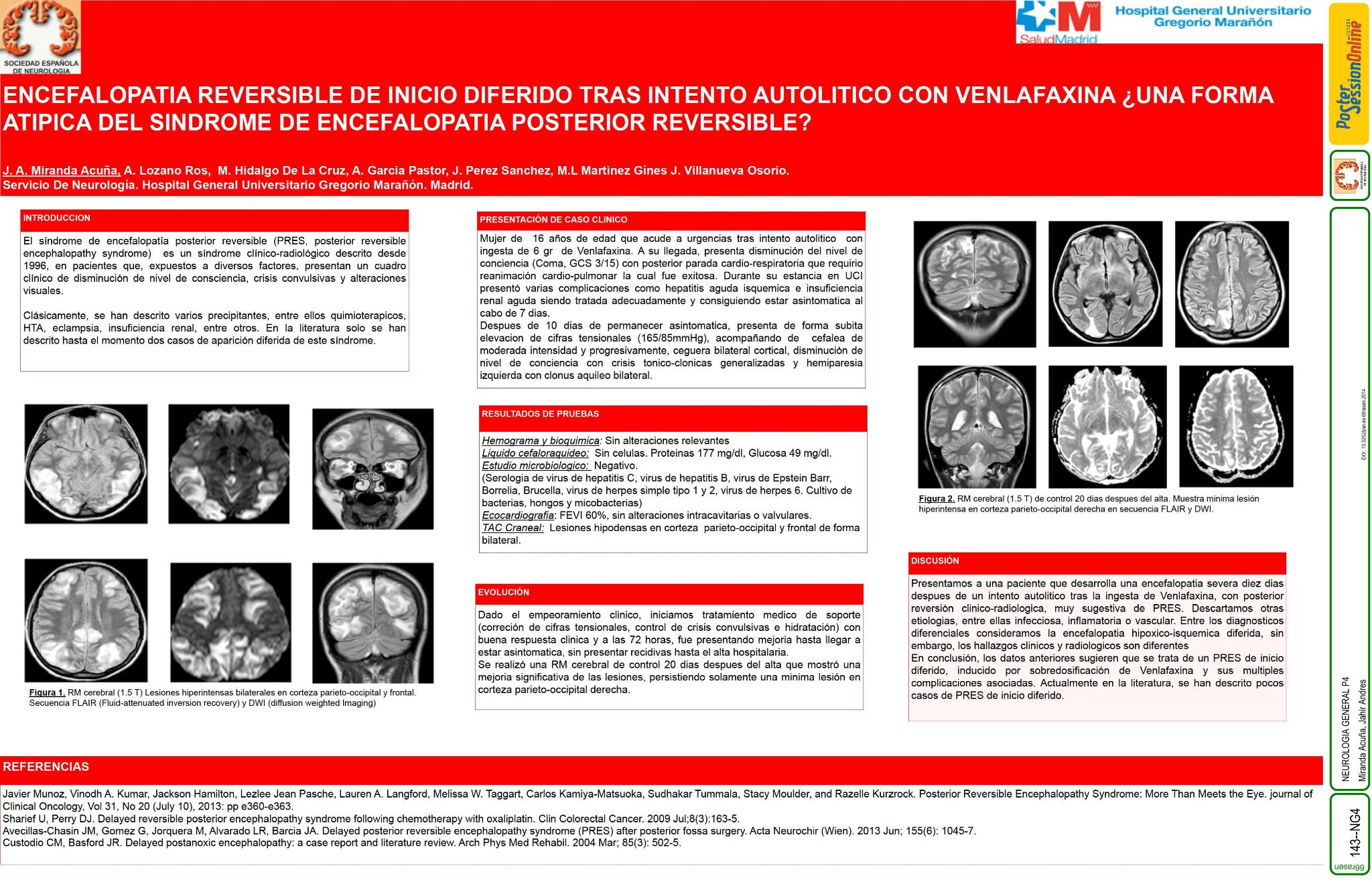 Encefalopatia reversible de inicio iferido tras intento autolitico con venlafaxina. ¿Una forma atípica del síndrome de encefalopatía posterior reversible?