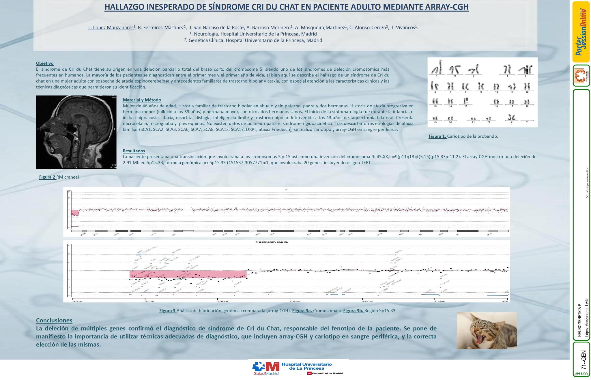 Hallazgo inesperado de síndrome Cri du chat en paciente adulto mediante array-CGH