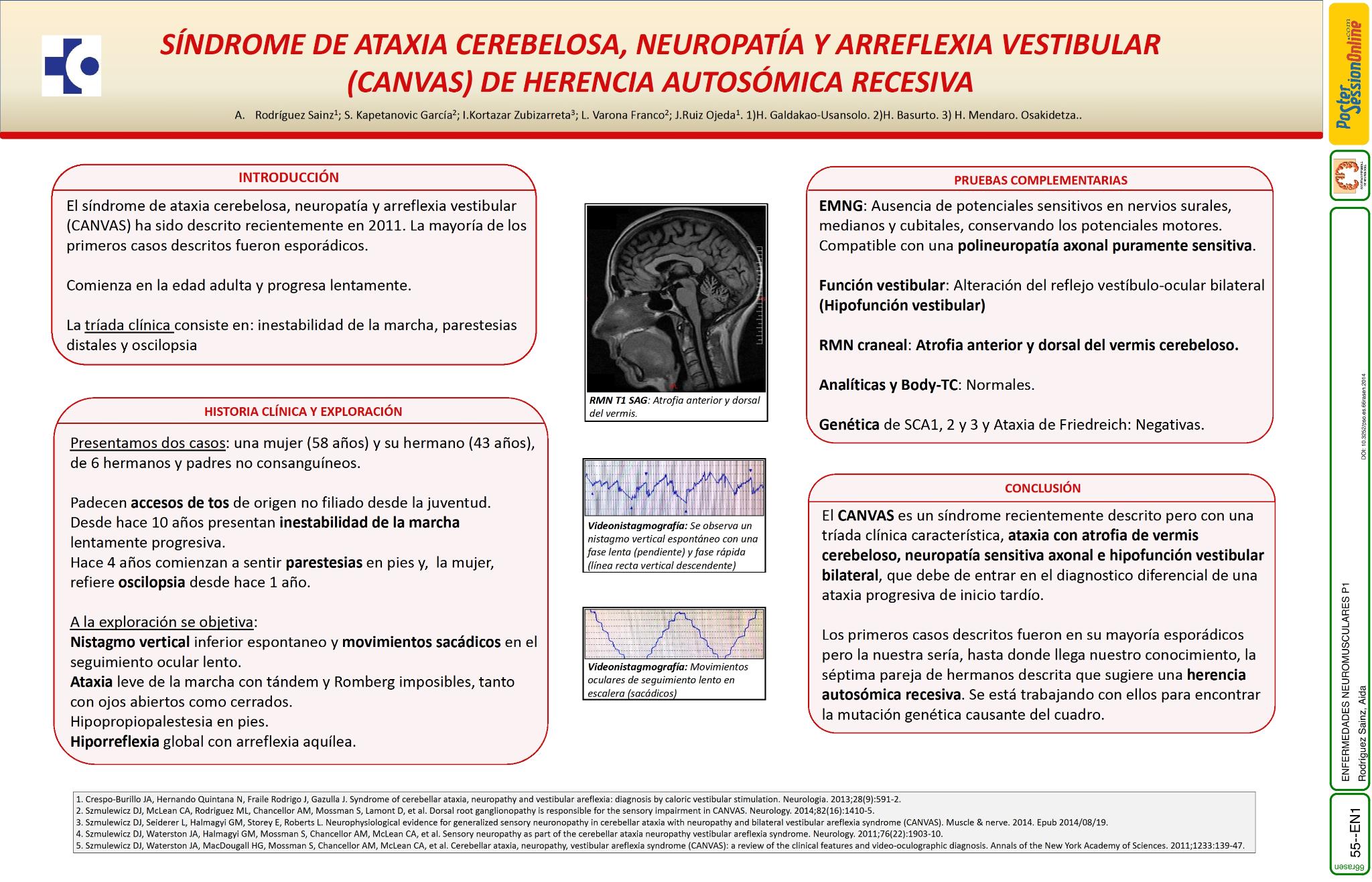 Síndrome de ataxia cerebelosa, neuropatía y arreflexia vestibular (CANVAS) de herencia autosómica recesiva