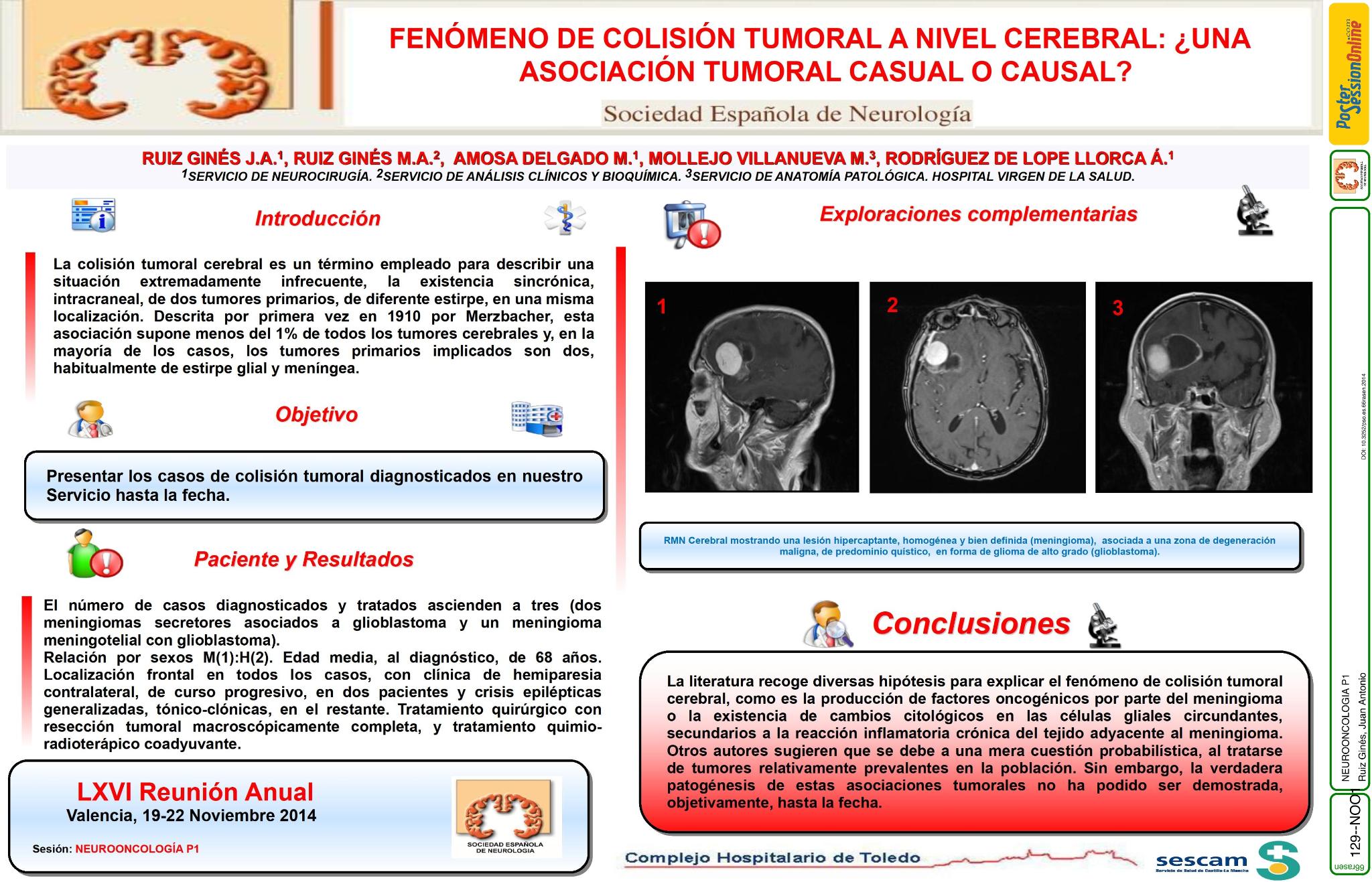 Fenómeno de colisión tumoral a nivel cerebral: ¿Una asociación tumoral casual o causal?
