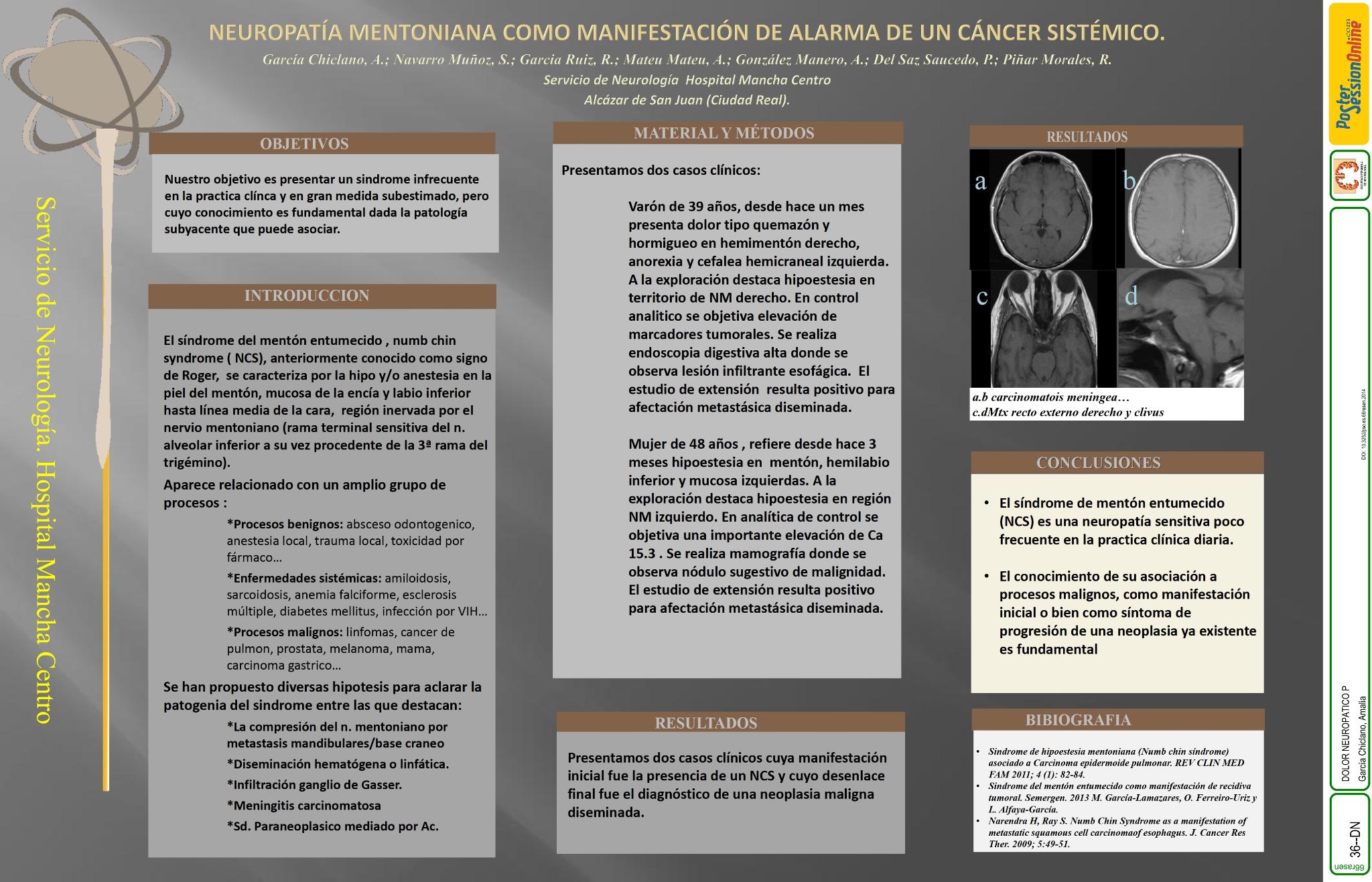 Neuropatía mentoniana como manifestación de alarma de un cáncer sistémico