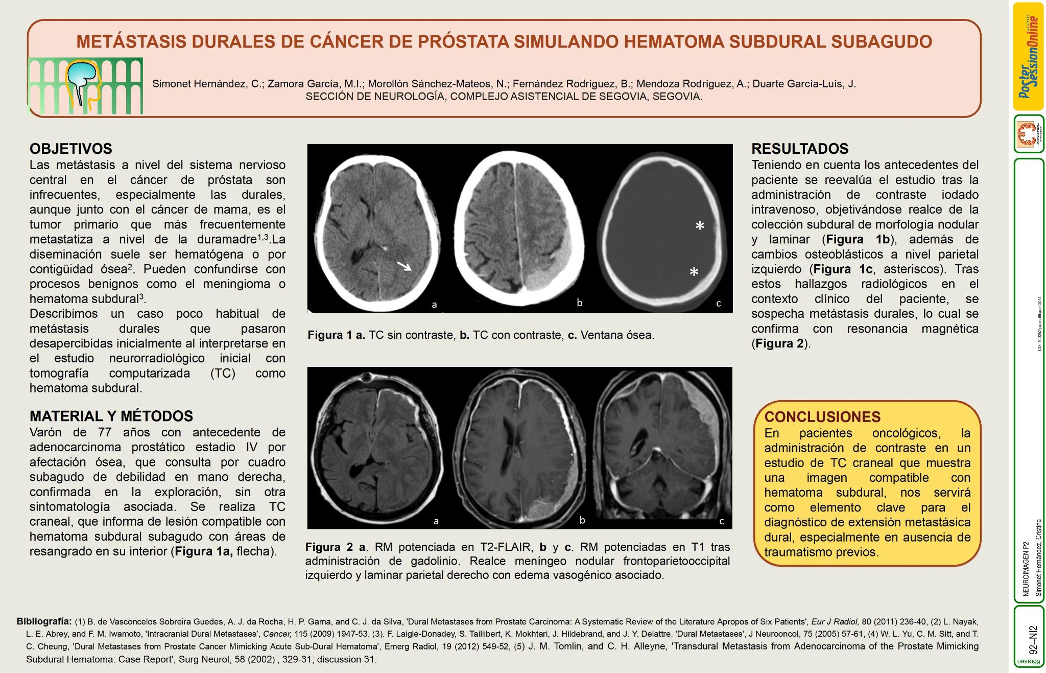 Metástasis durales de cáncer de próstata simulando hematoma subdural subagudo