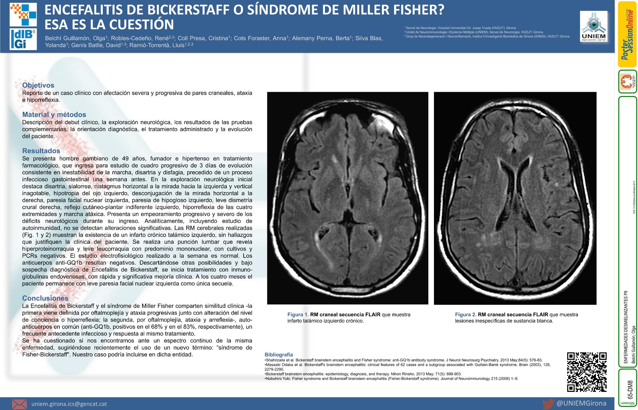 Encefalitis de Bickerstaff o síndrome de Miller Fisher? Esa es la cuestión