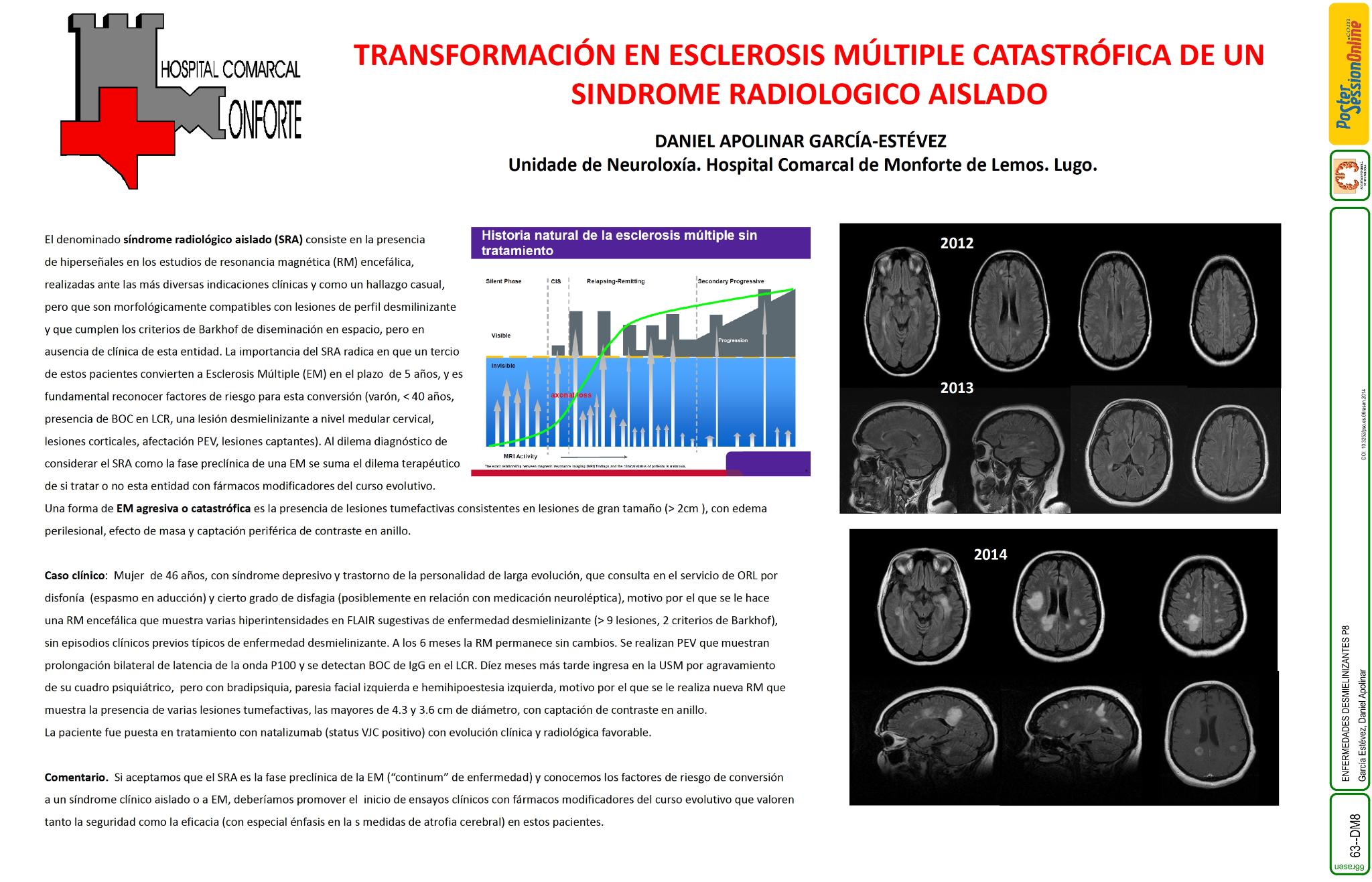 Transformación en esclerosis múltiple catastrófica de un síndrome radiológico aislado