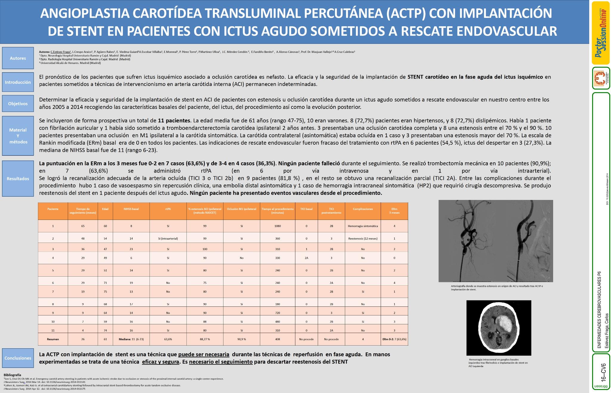Angioplastia carotídea transluminal percutánea (ACTP) con implantación de stent en pacientes con ictus agudo sometidos a rescate endovascular