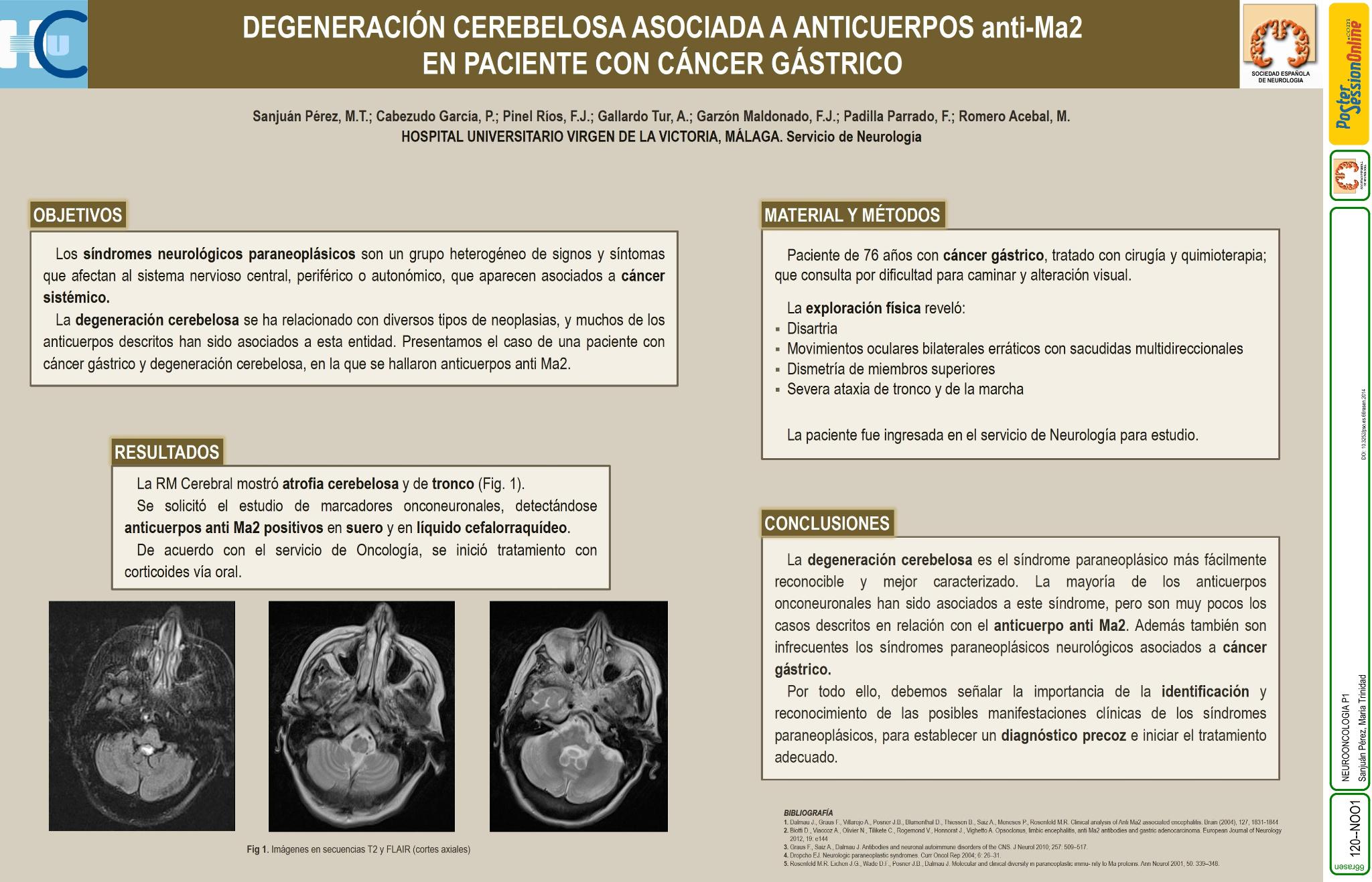 Degeneración cerebelosa asociada a anticuerpos anti-Ma2 en paciente con cáncer gástrico
