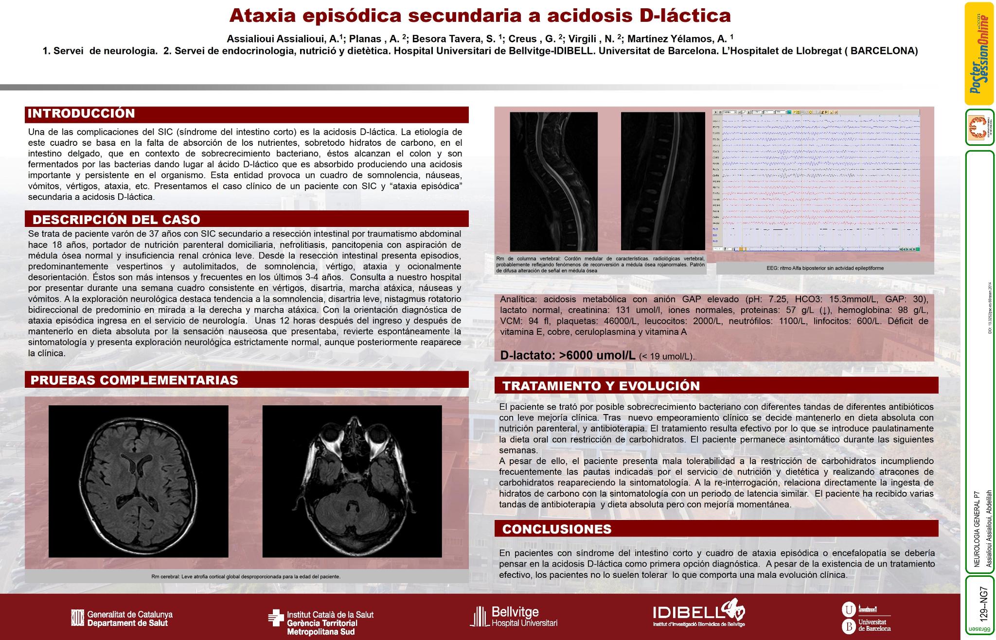 Ataxia episódica secundaria a acidosis D-láctica