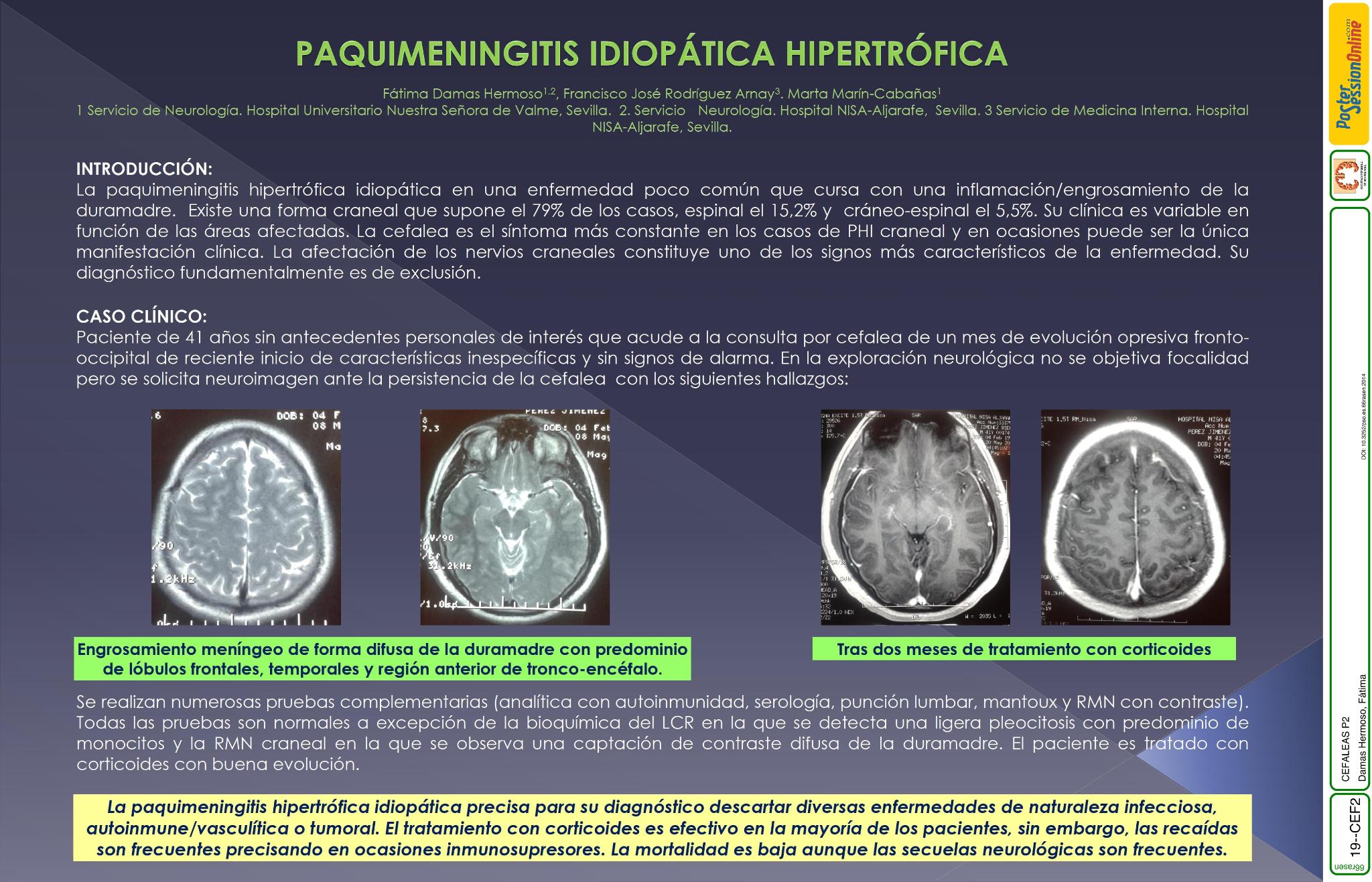 Paquimengintis hipertrófica idiopática