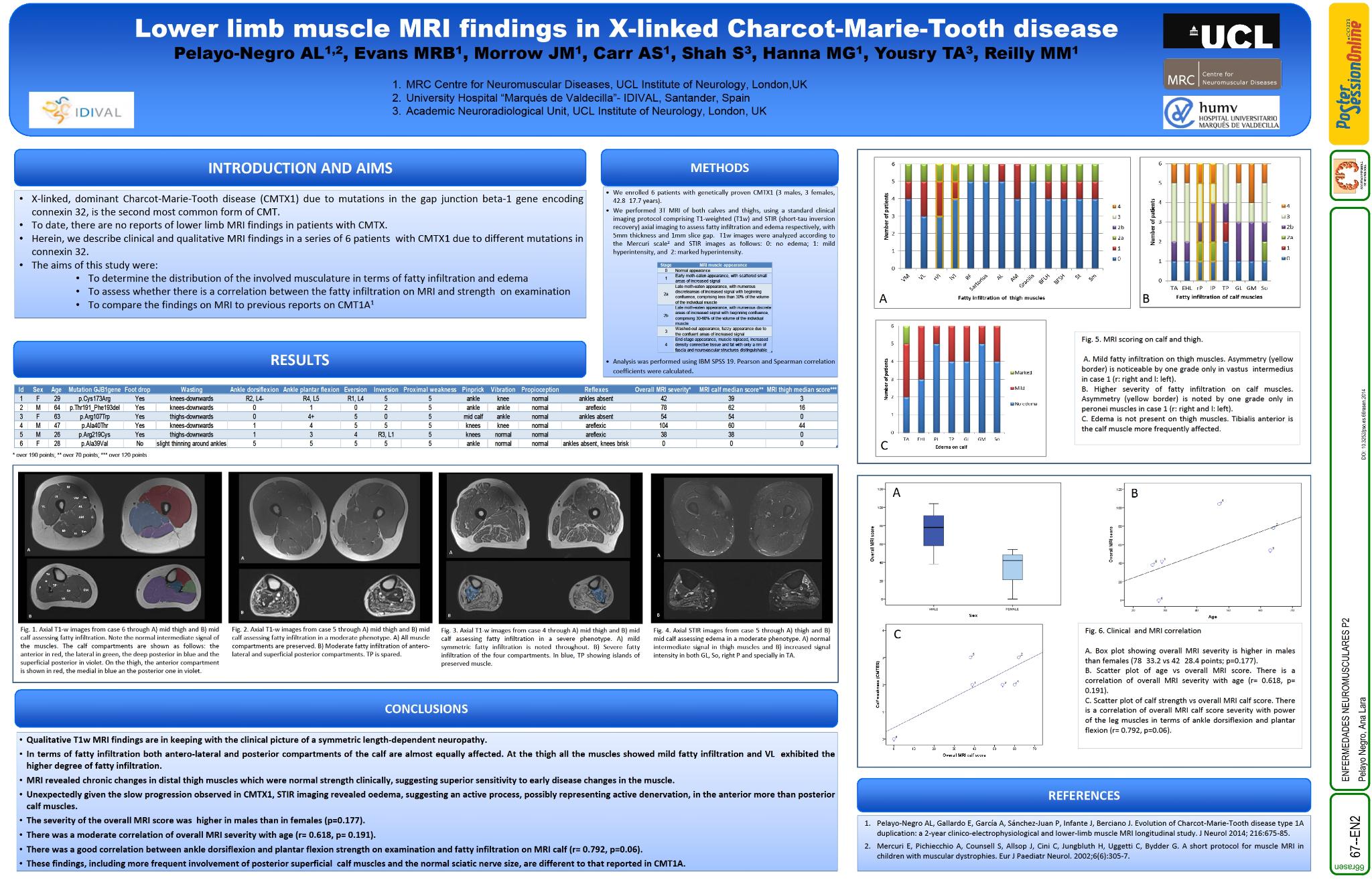 Hallazgos de RM en miembros inferiores en la enfermedad de Charcot-Marie-Tooth ligada al cromosoma X