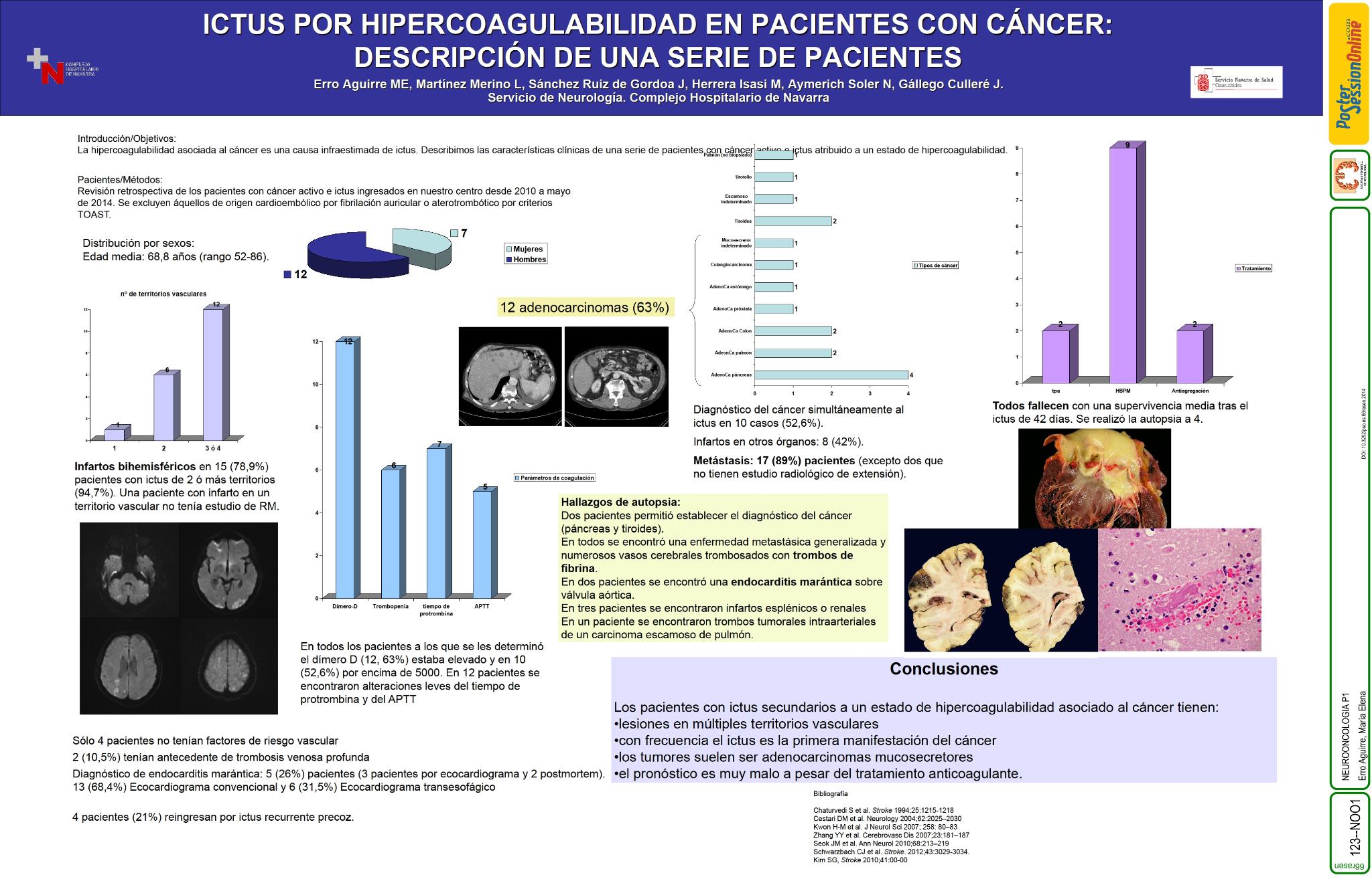 Ictus por hipercoagulabilidad en pacientes con cáncer: descripción de una serie de pacientes