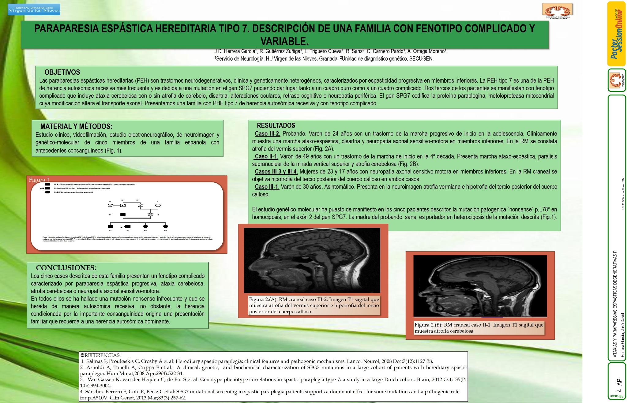 Paraparesia espástica hereditaria tipo 7. Descripción de una familia con variedad de fenotipos