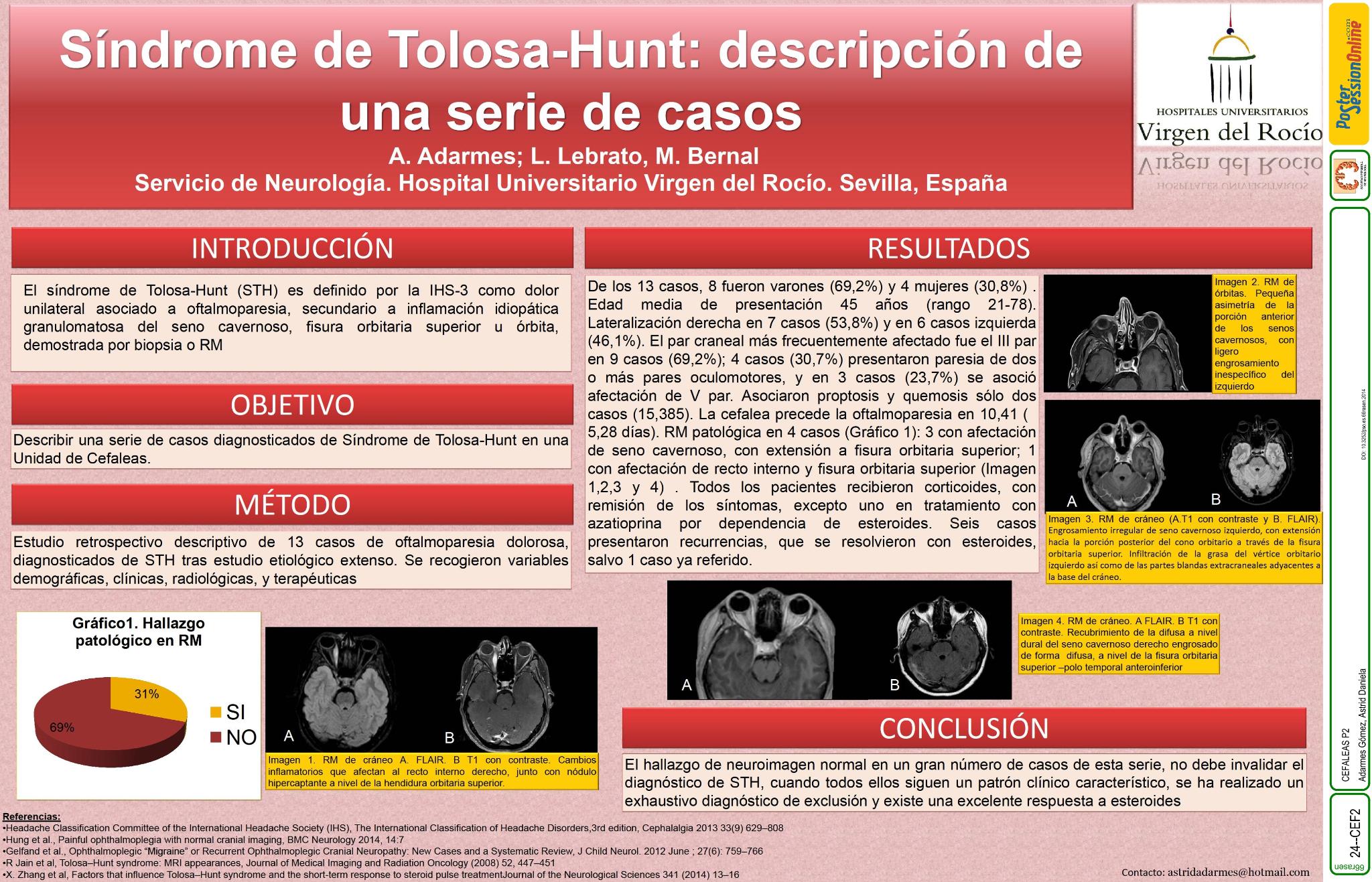 Síndrome de Tolosa-Hunt: descripción de una serie de casos
