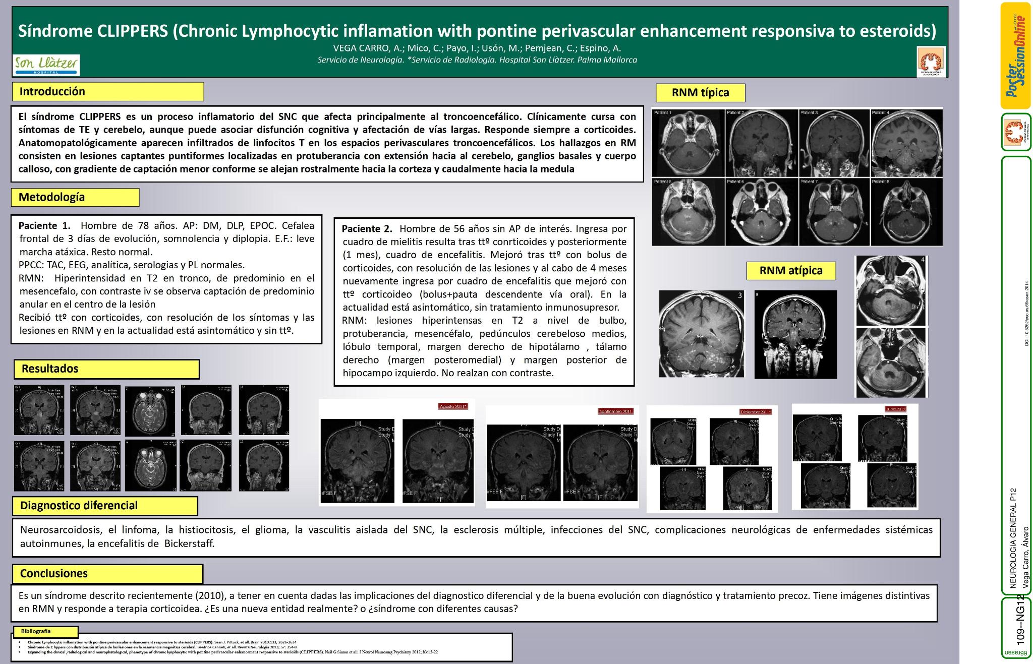 Síndrome CLIPPERS (Chronic Lymphocytic inflamation with pontine perivascular enhancement responsiva to esteroids)